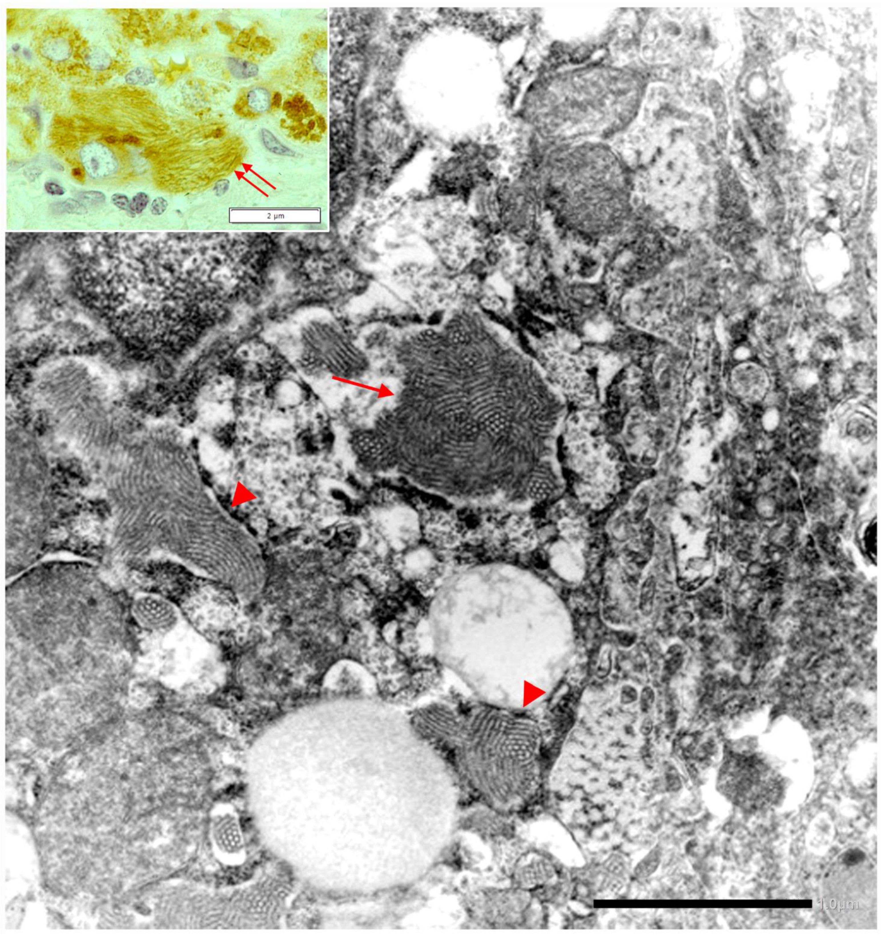 Ijms 22 05778 g017 Ijms 22 05778 g017