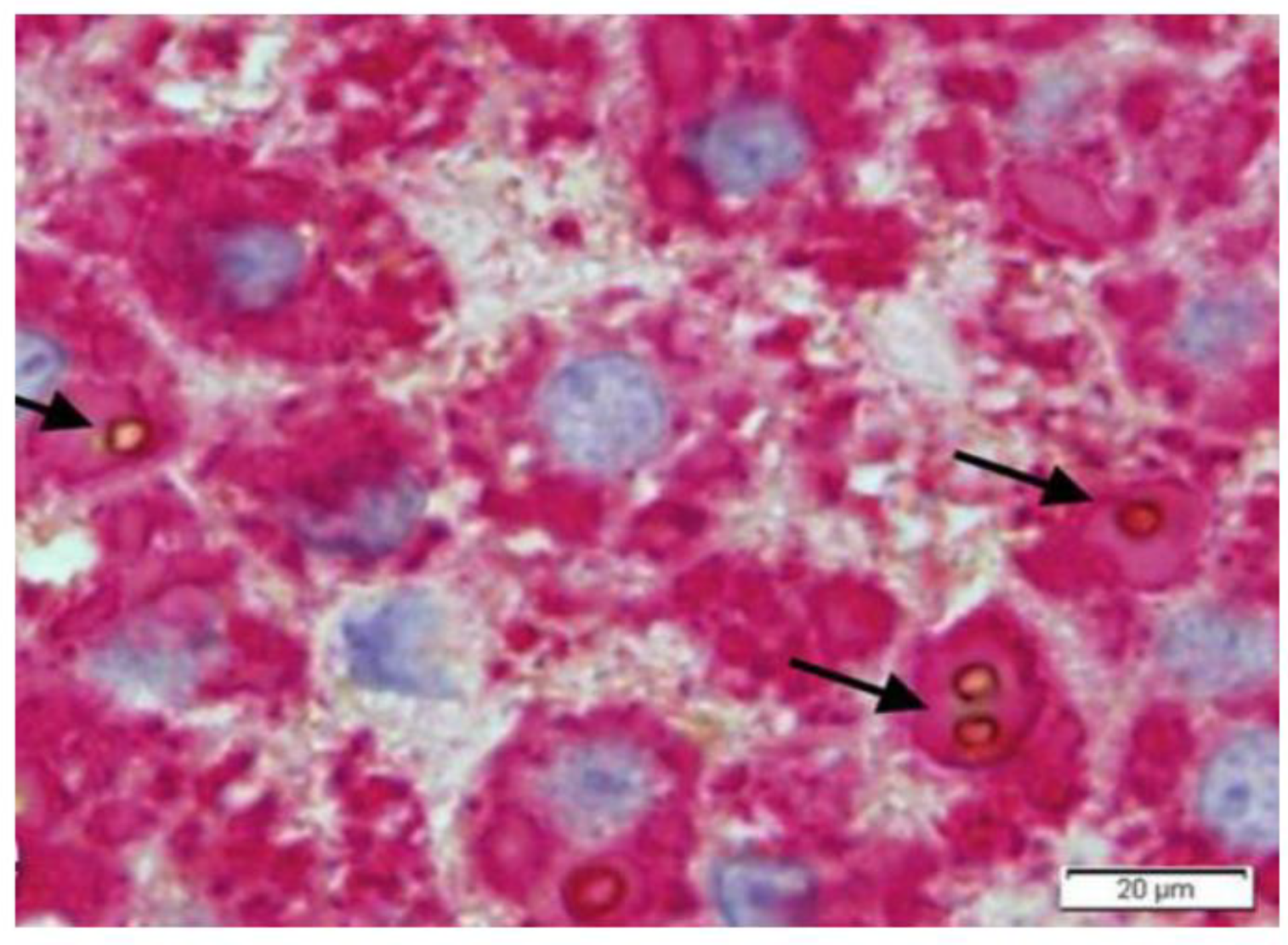 Ijms 22 05778 g018 Ijms 22 05778 g018