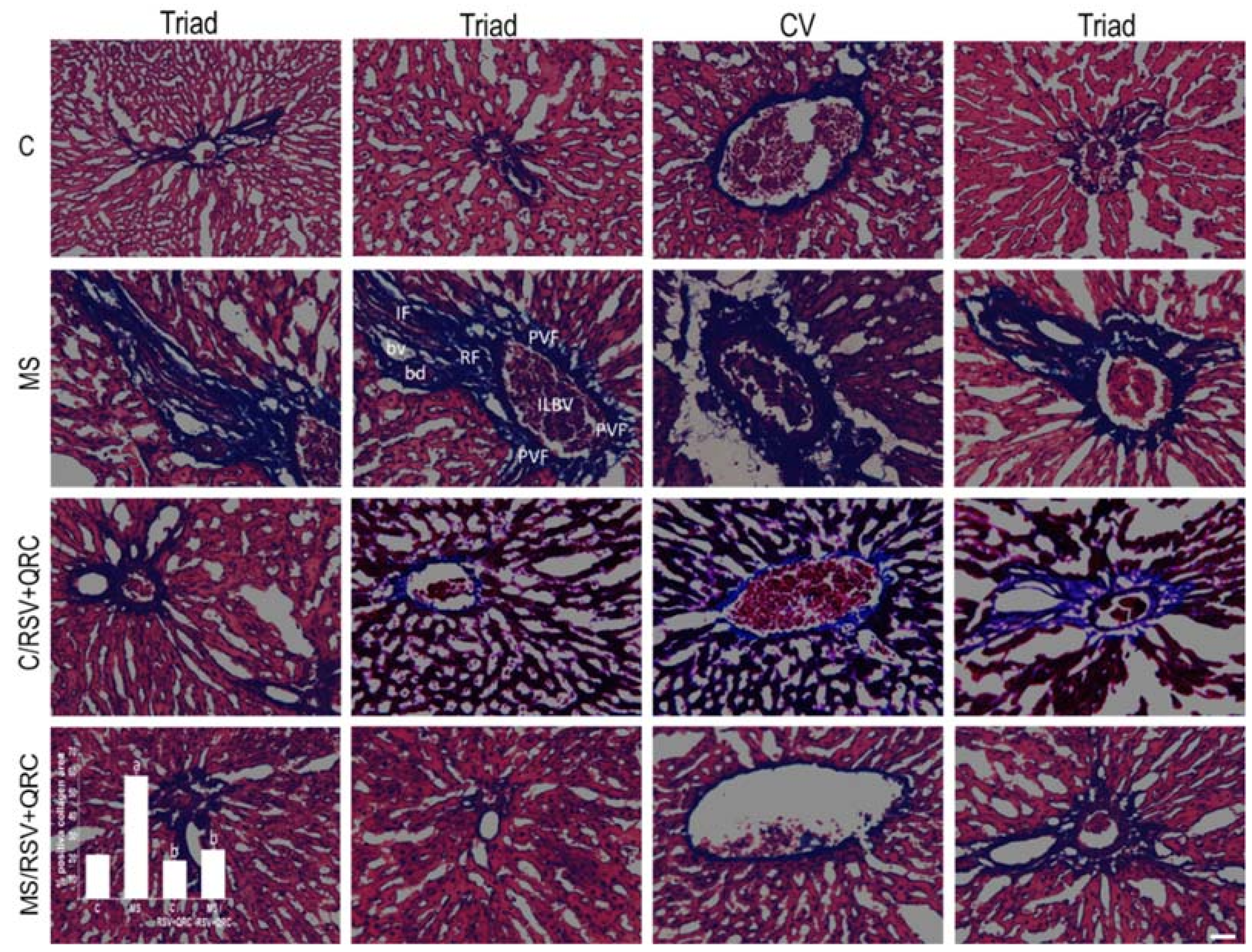 Ijms 22 08939 g004 Ijms 22 08939 g004