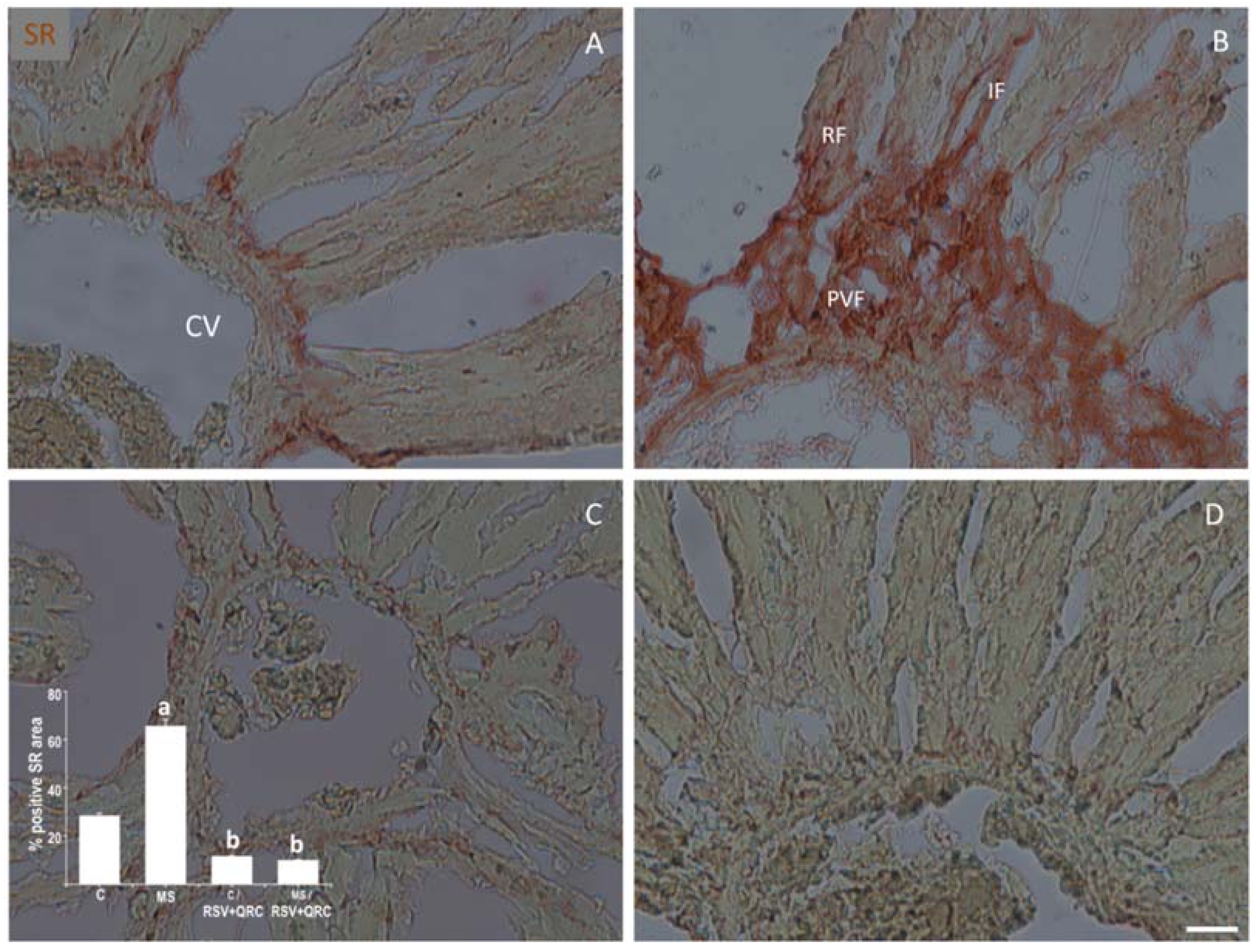 Ijms 22 08939 g005 Ijms 22 08939 g005