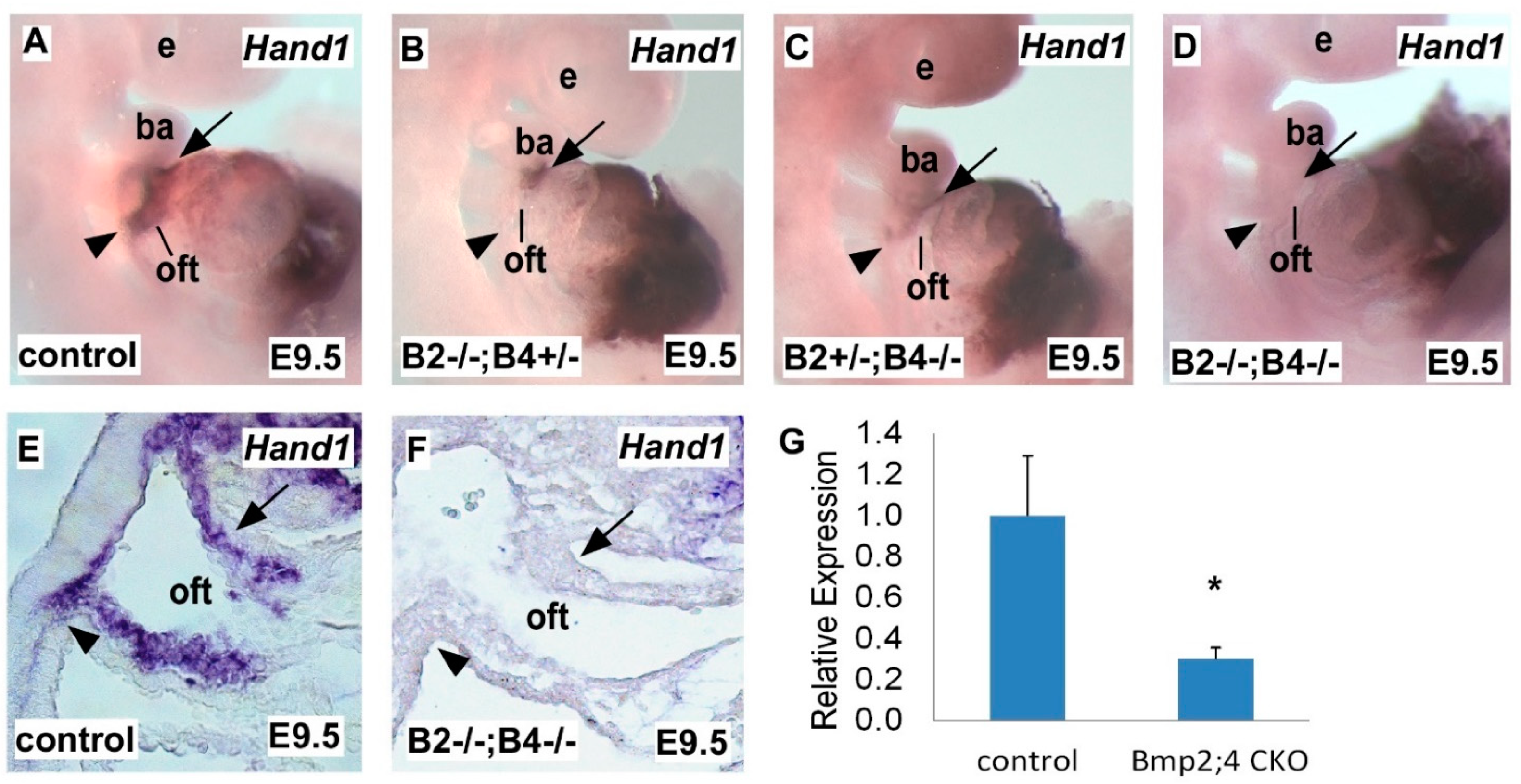 Bmp Signaling Regulates Hand1 in a Dose-Dependent Manner during Heart ...