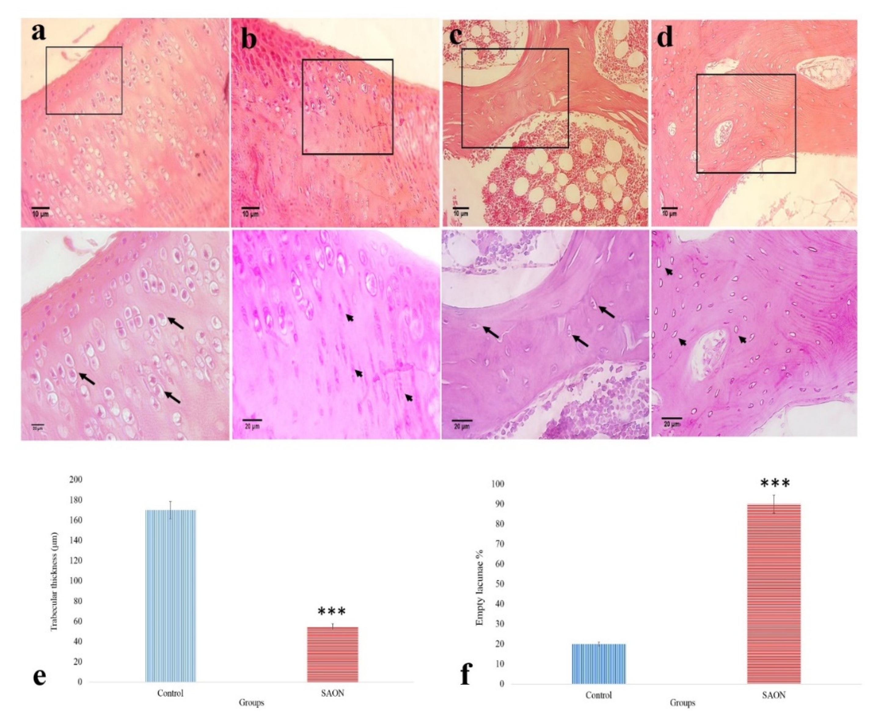 Regeneration of Bone Defects in a Rabbit Femoral Osteonecrosis Model ...