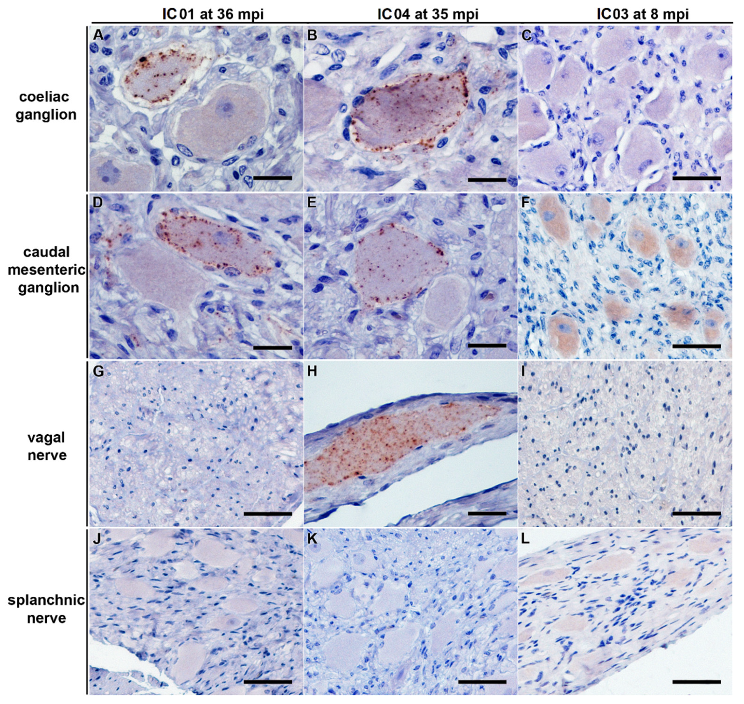 Ijms 22 11310 g004 Ijms 22 11310 g004