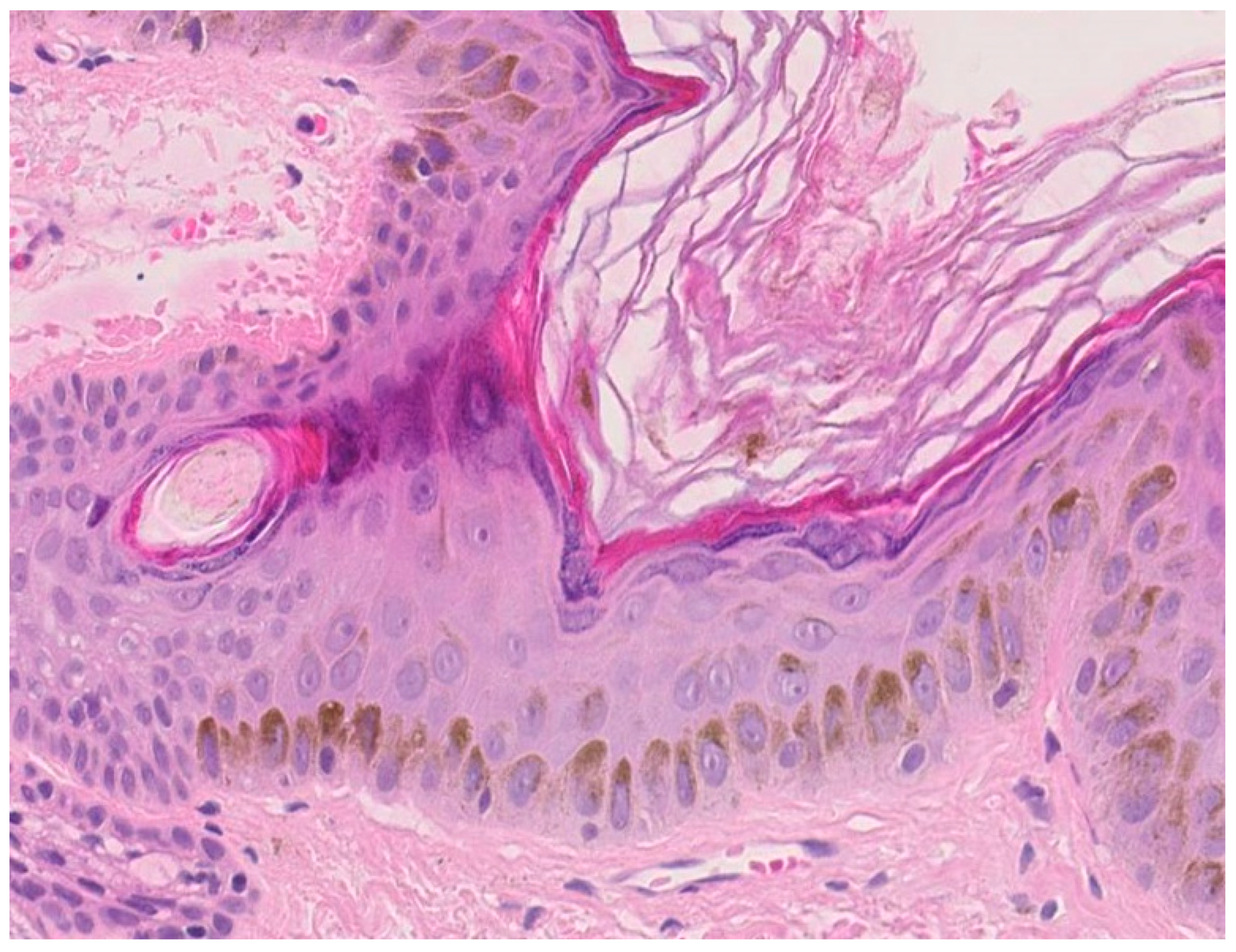 Ijms 22 11676 g003 Ijms 22 11676 g003