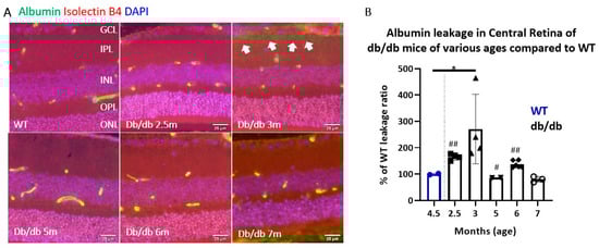 Ijms 22 11876 g0a1 550