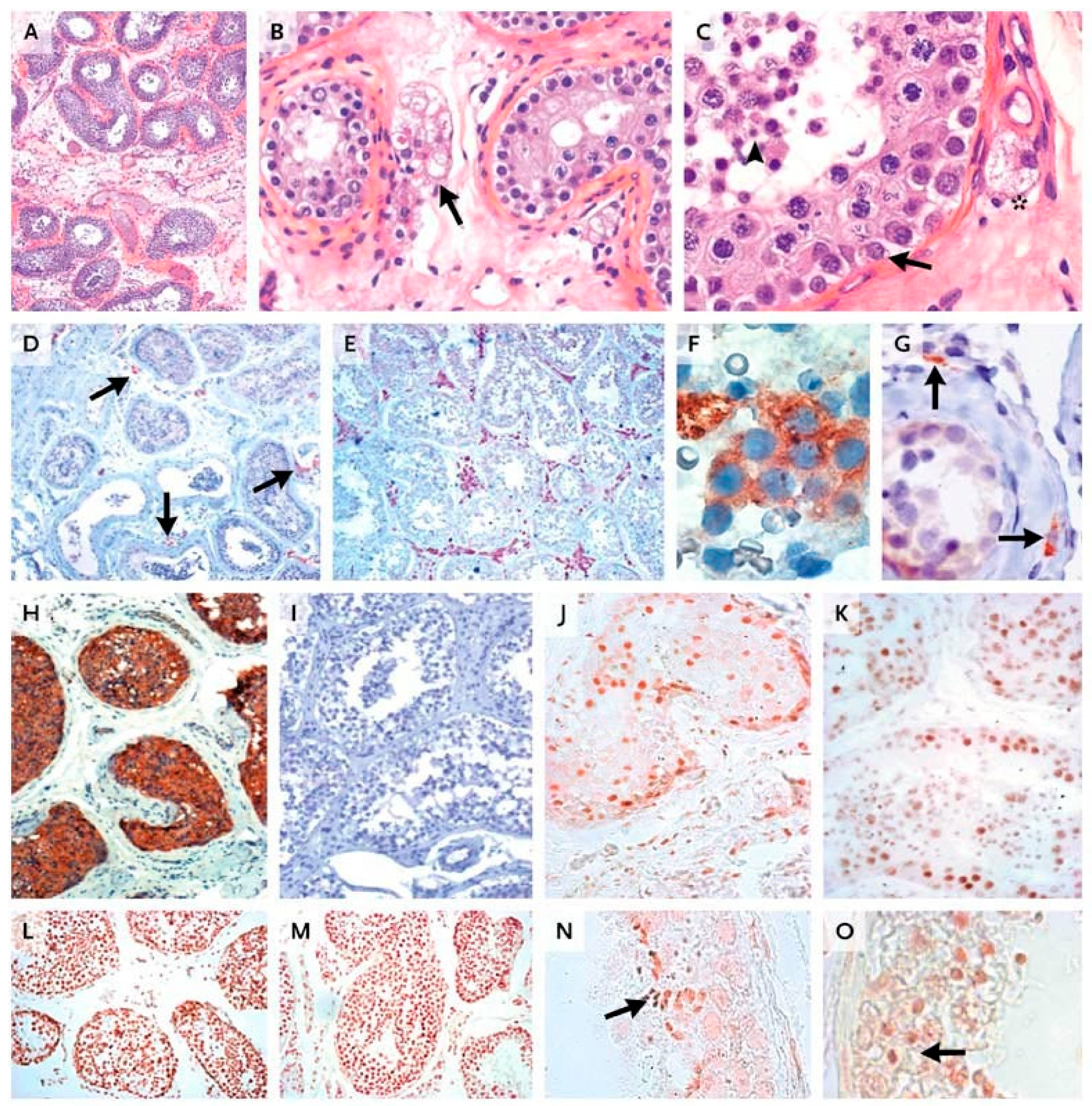 Ijms 22 12735 g004 Ijms 22 12735 g004