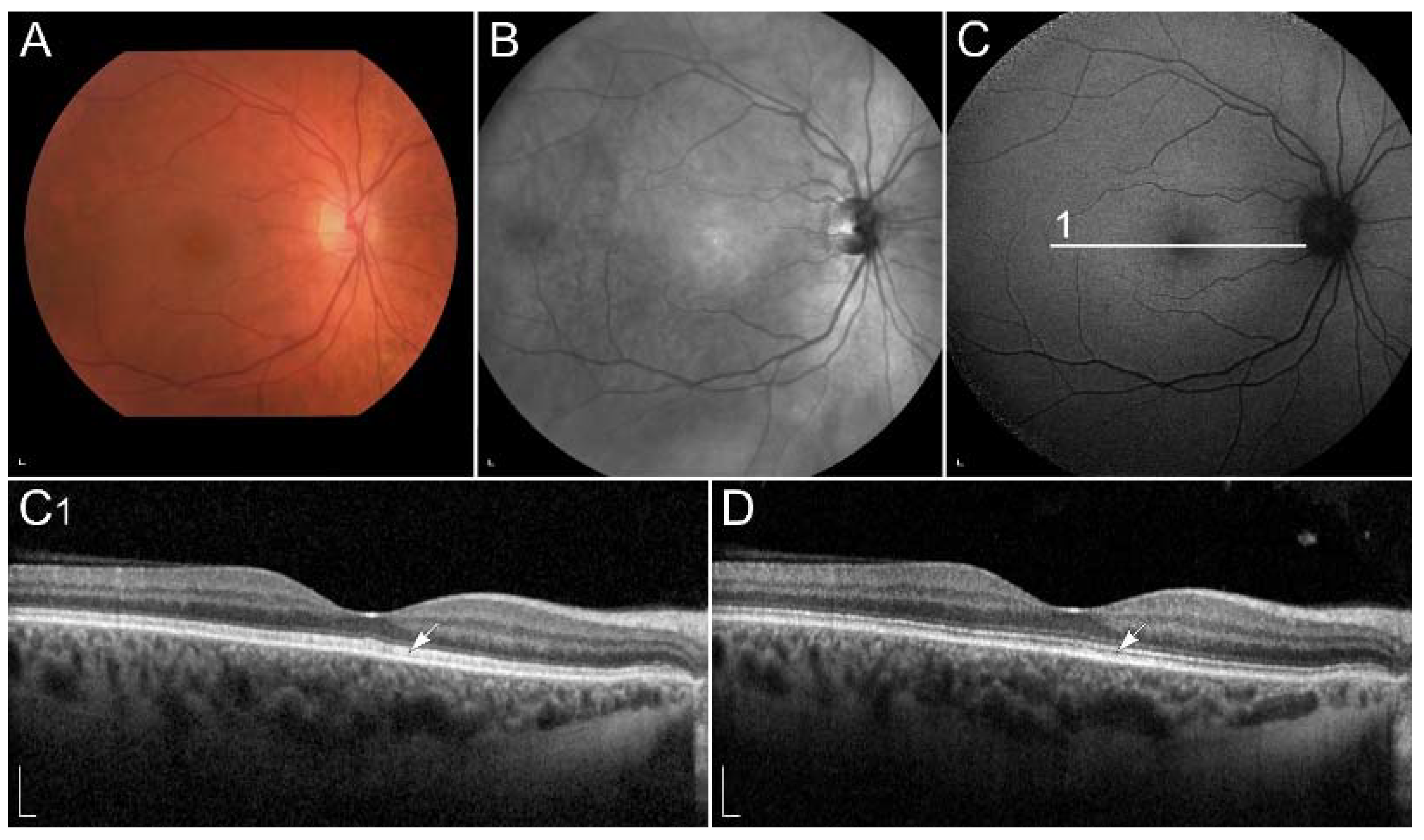 Ijms 23 01014 g002 Ijms 23 01014 g002