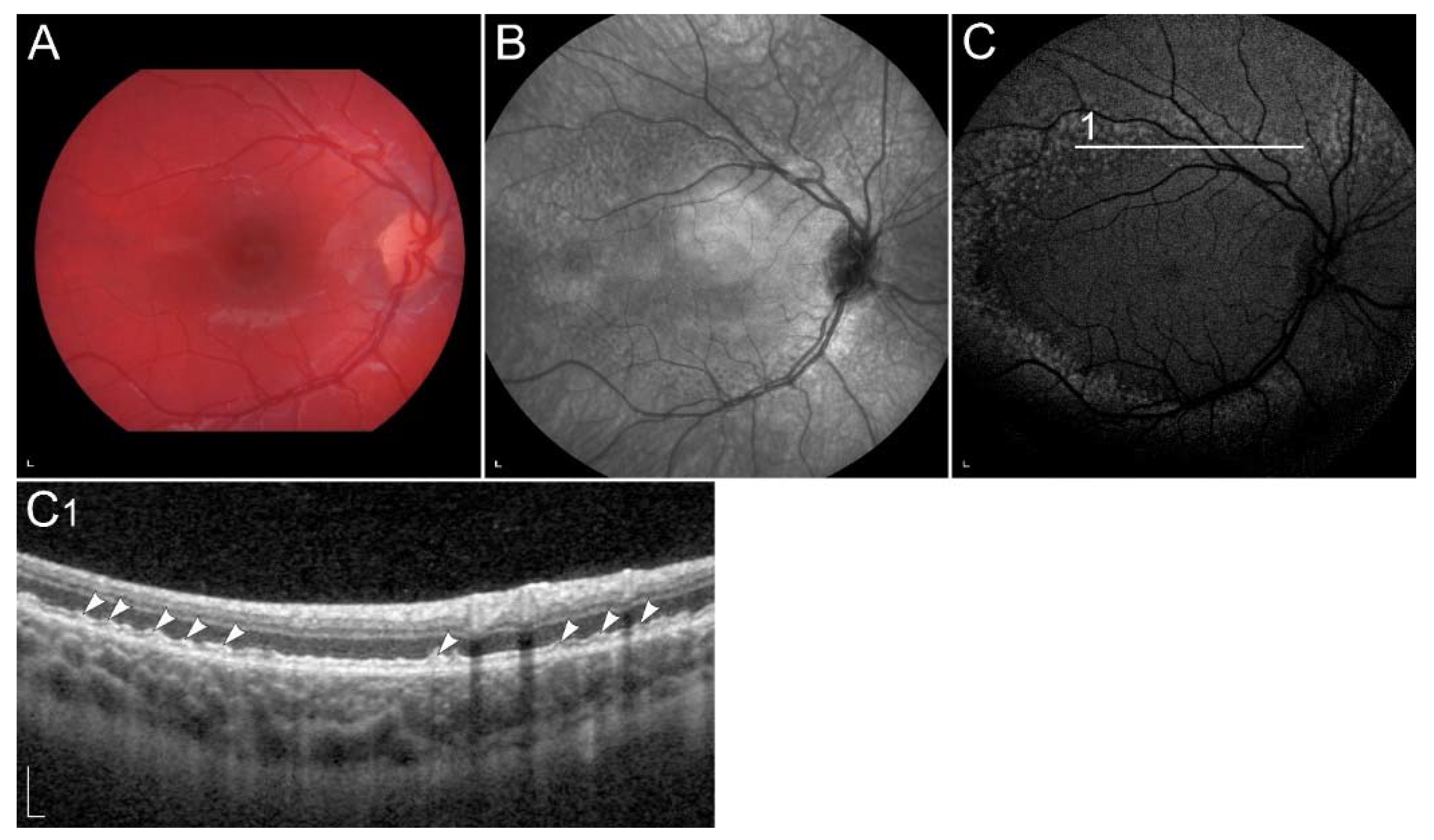 Ijms 23 01014 g005 Ijms 23 01014 g005