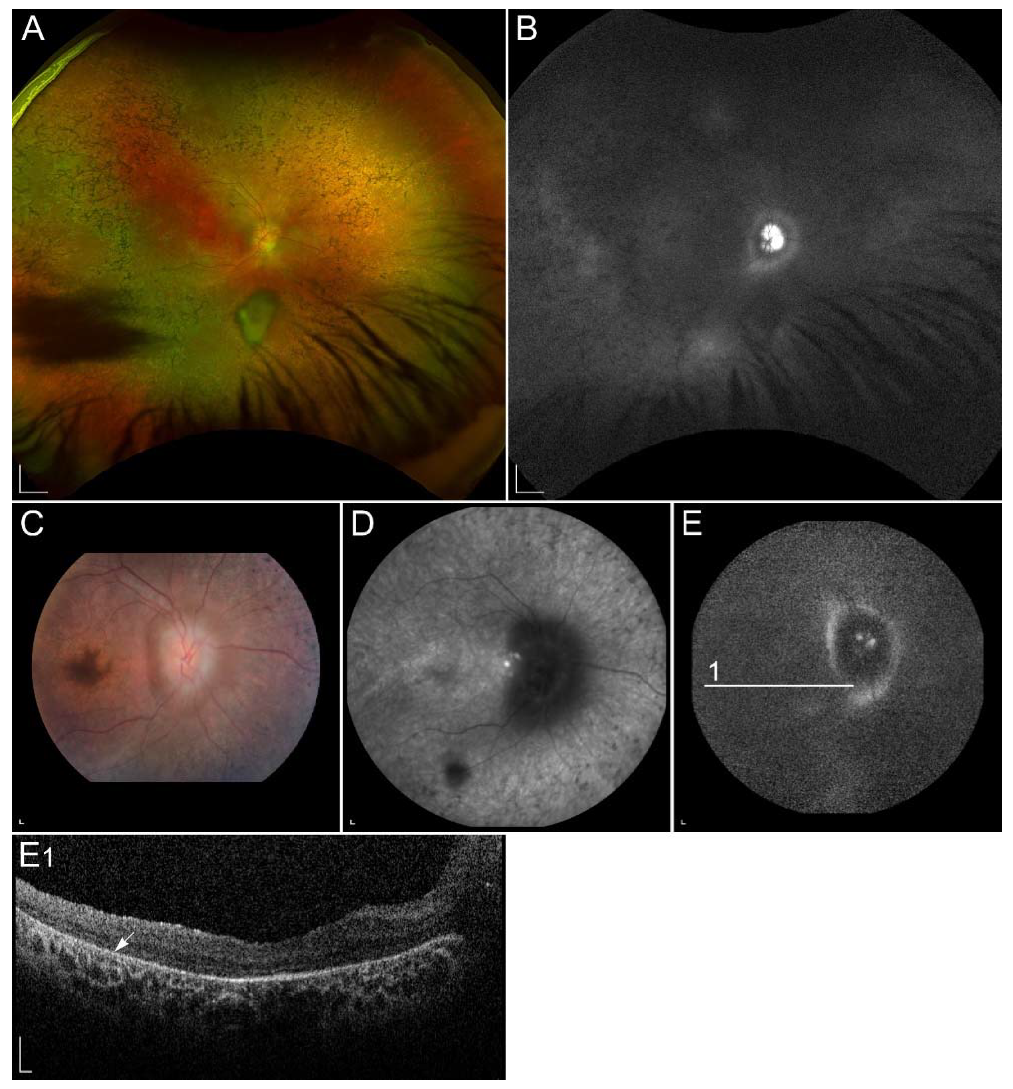 Ijms 23 01014 g006 Ijms 23 01014 g006