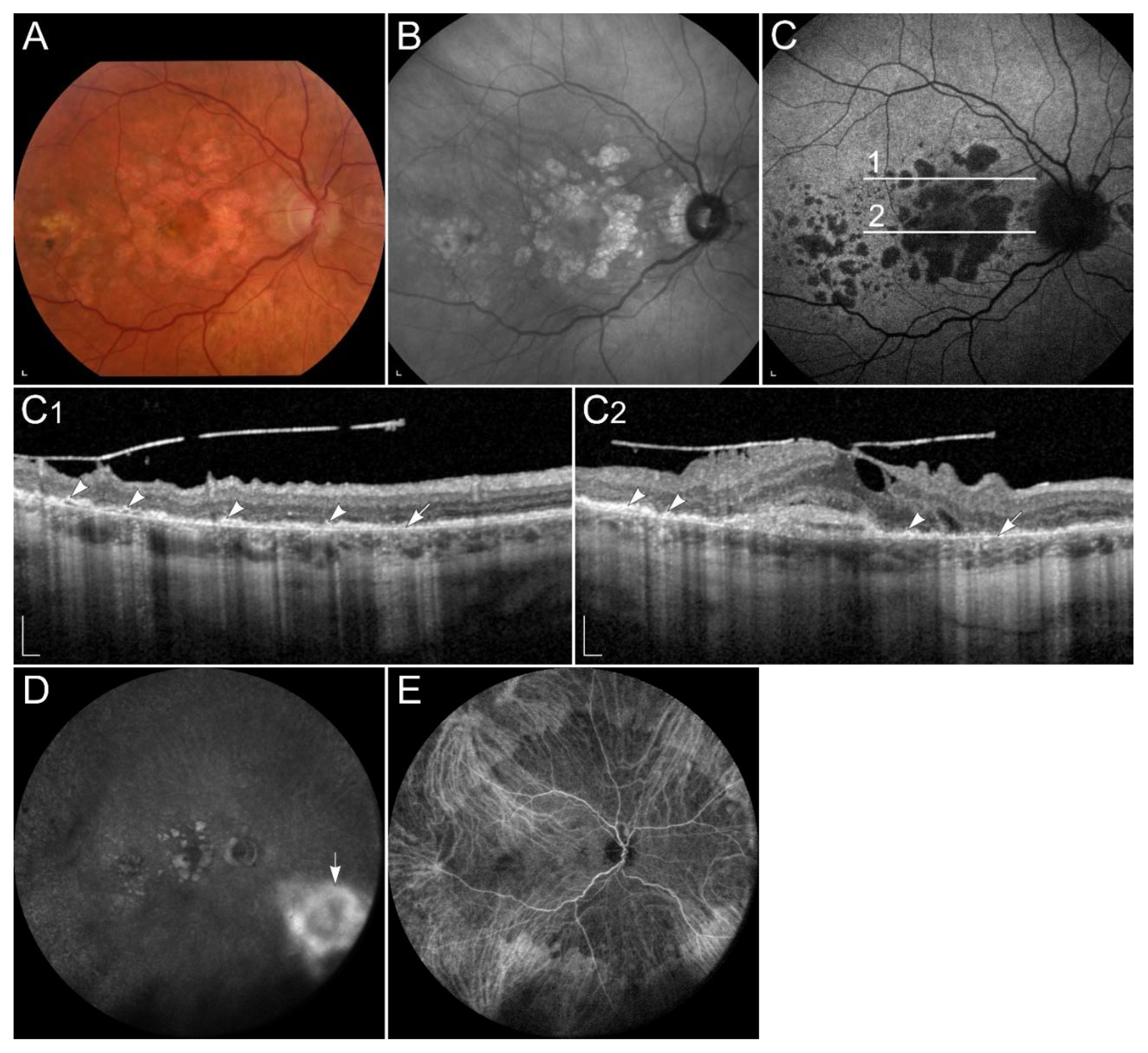 Ijms 23 01014 g007 Ijms 23 01014 g007