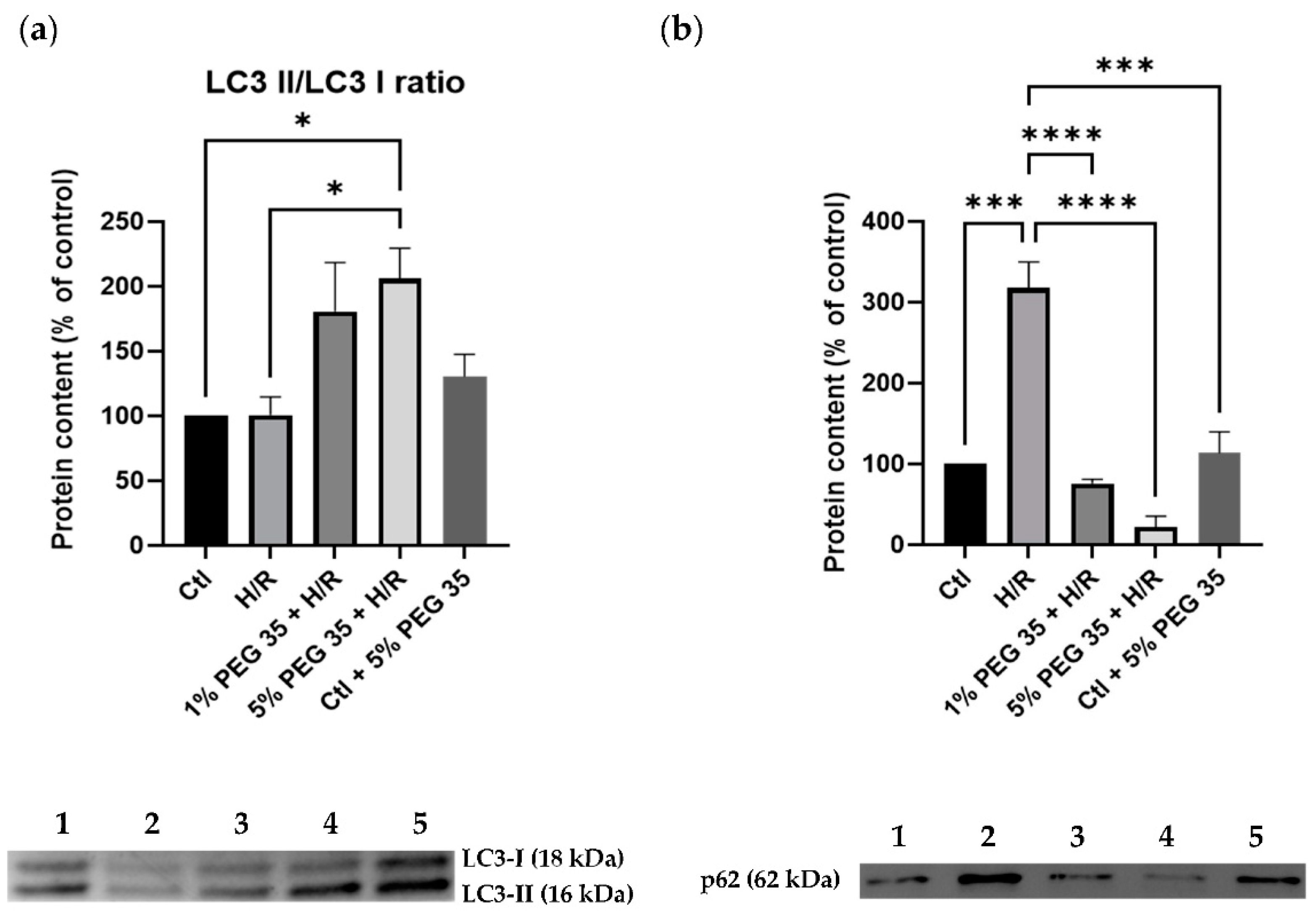 Ijms 23 01156 g004 Ijms 23 01156 g004