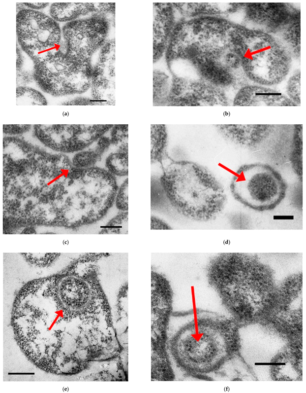 Ijms 23 04345 g001 Ijms 23 04345 g001