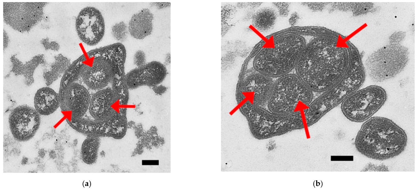 Ijms 23 04345 g002 Ijms 23 04345 g002