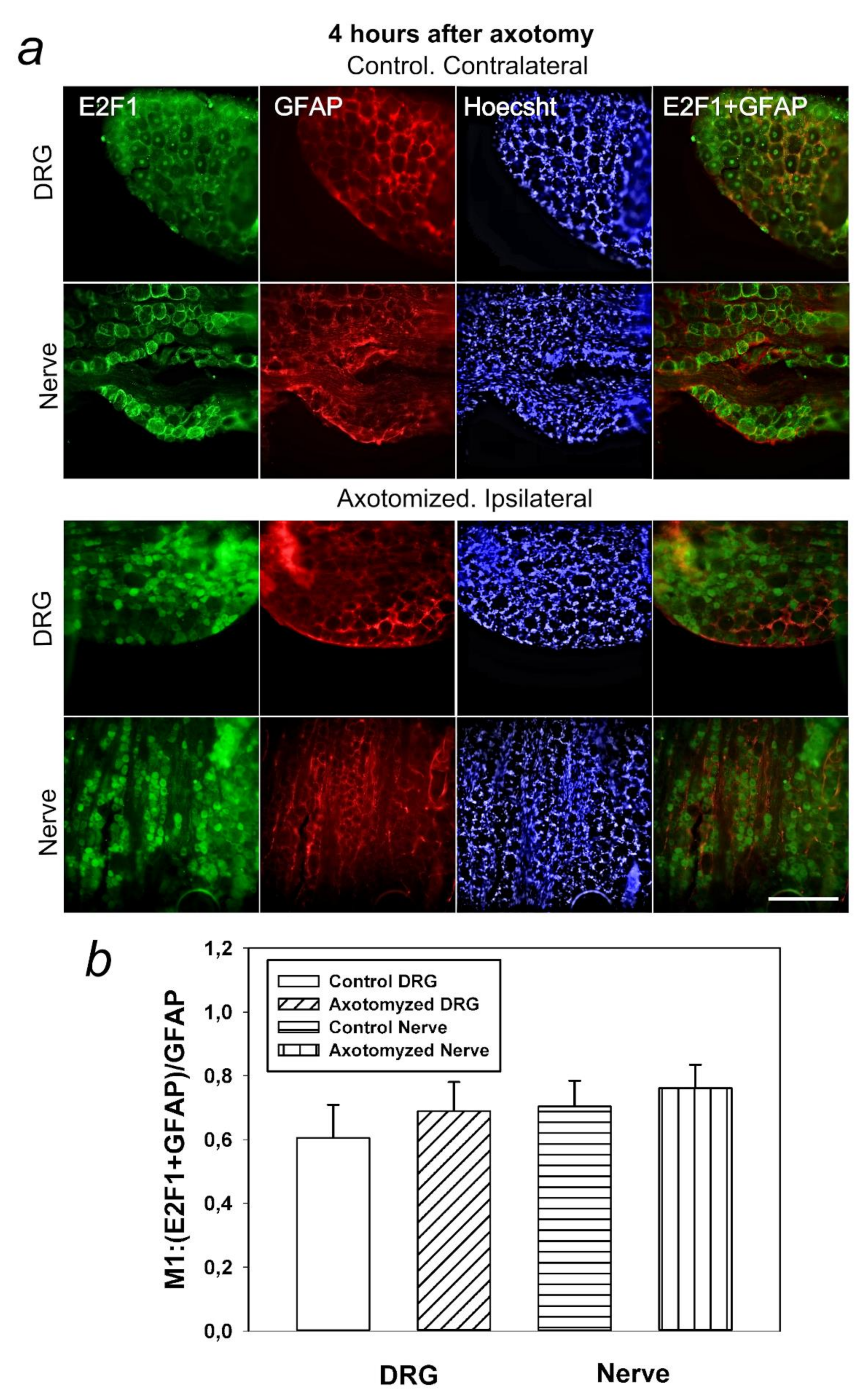 Ijms 23 04451 g004 Ijms 23 04451 g004