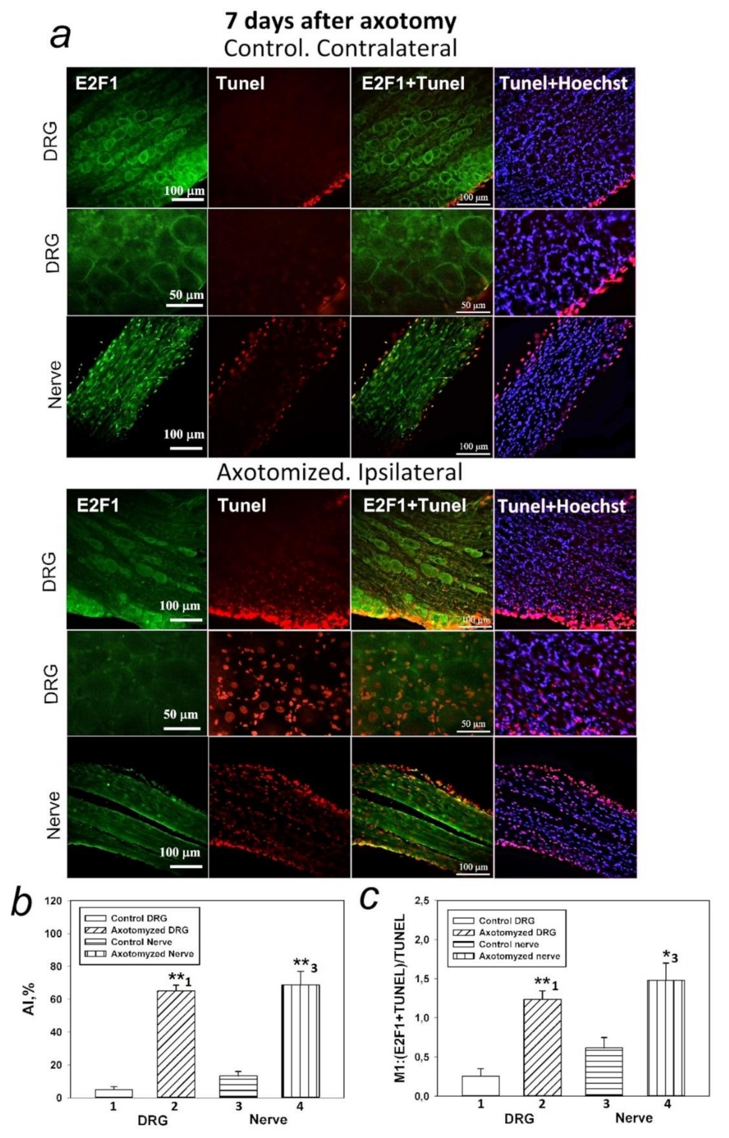 Ijms 23 04451 g005 Ijms 23 04451 g005