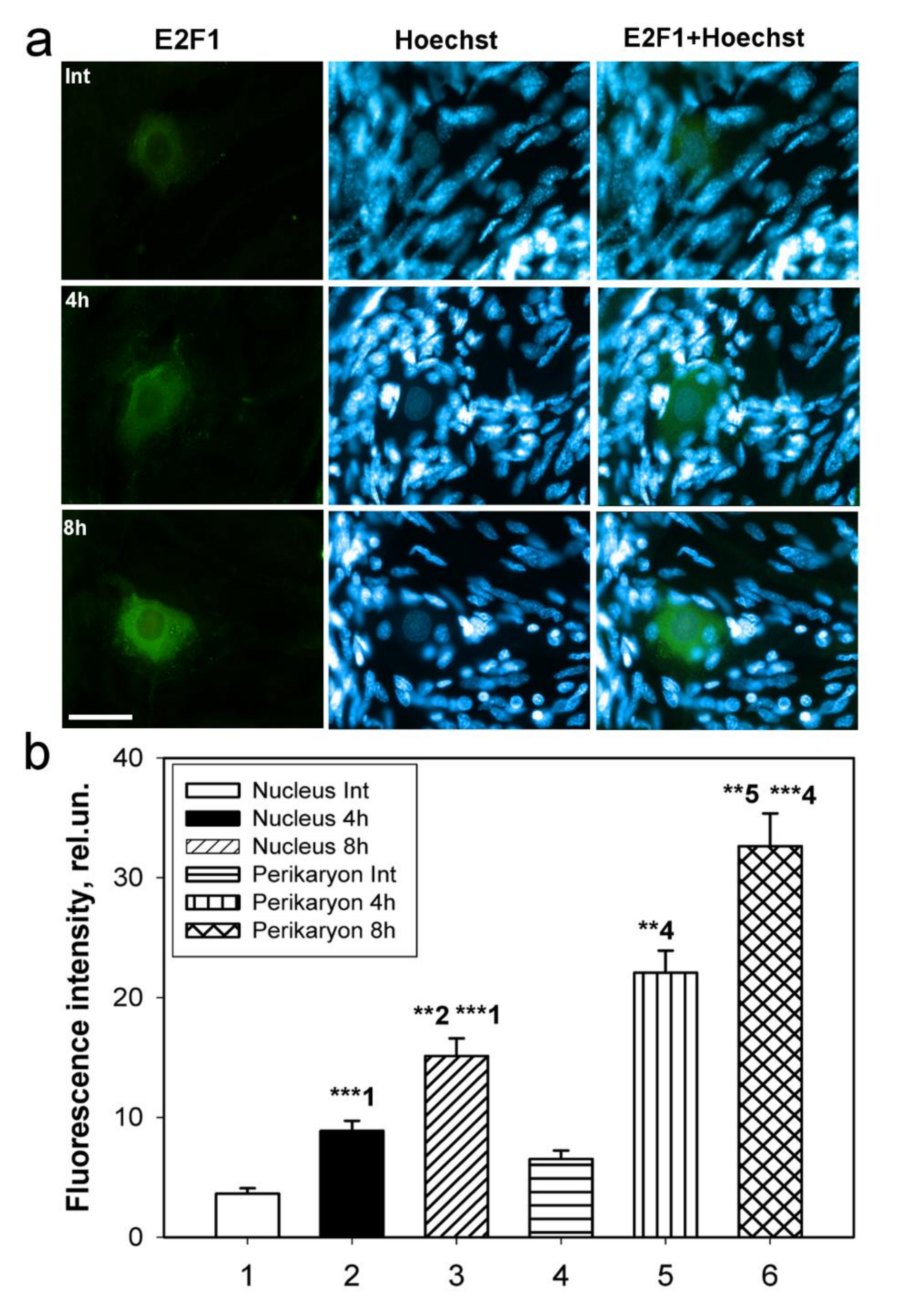 Ijms 23 04451 g006 Ijms 23 04451 g006