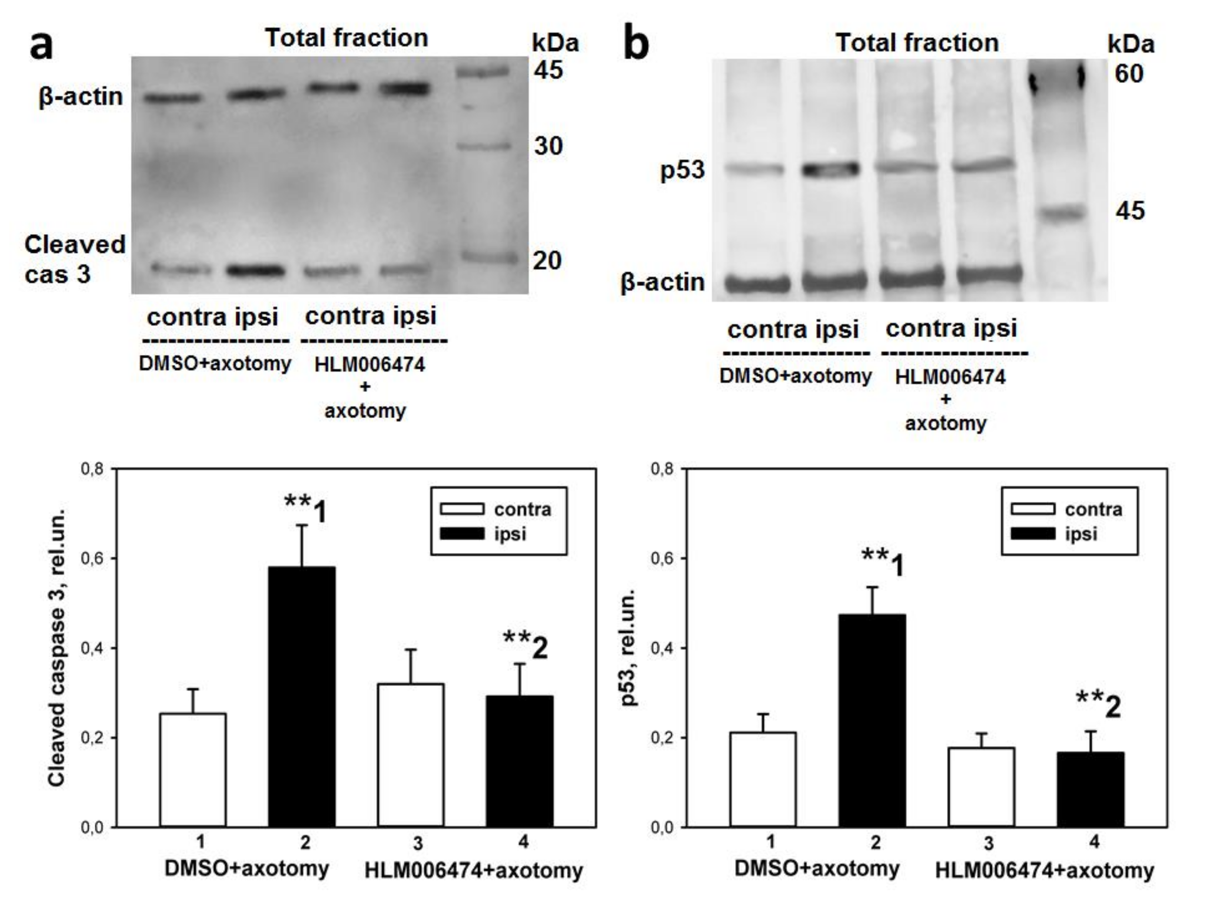 Ijms 23 04451 g008 Ijms 23 04451 g008