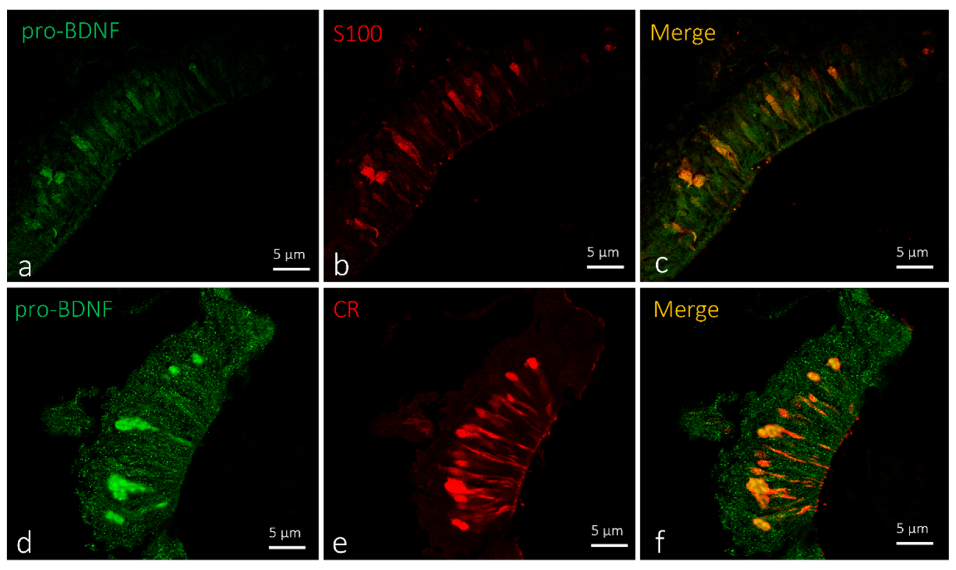Ijms 23 04696 g002 Ijms 23 04696 g002