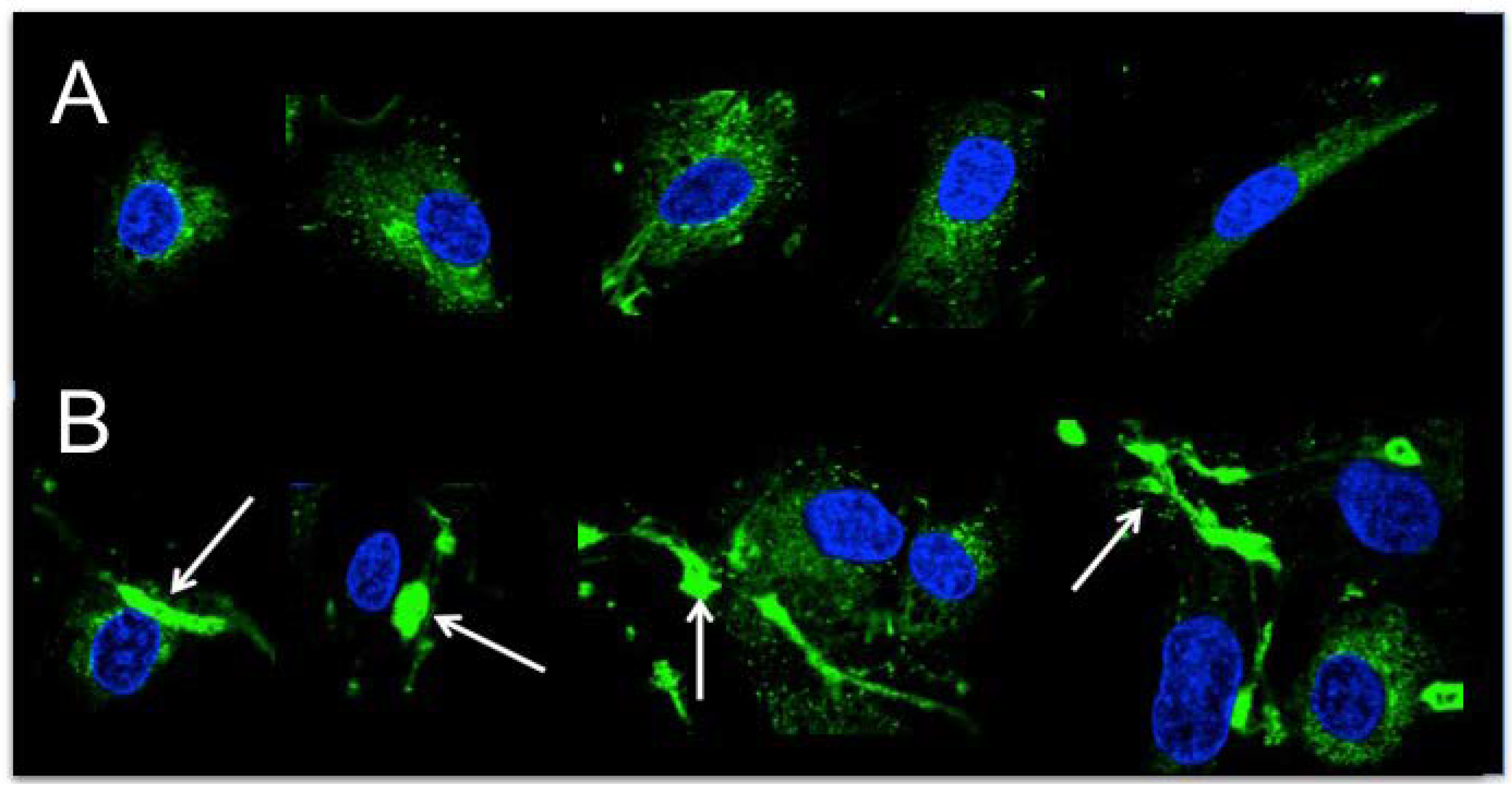 Ijms 23 05845 g006 Ijms 23 05845 g006