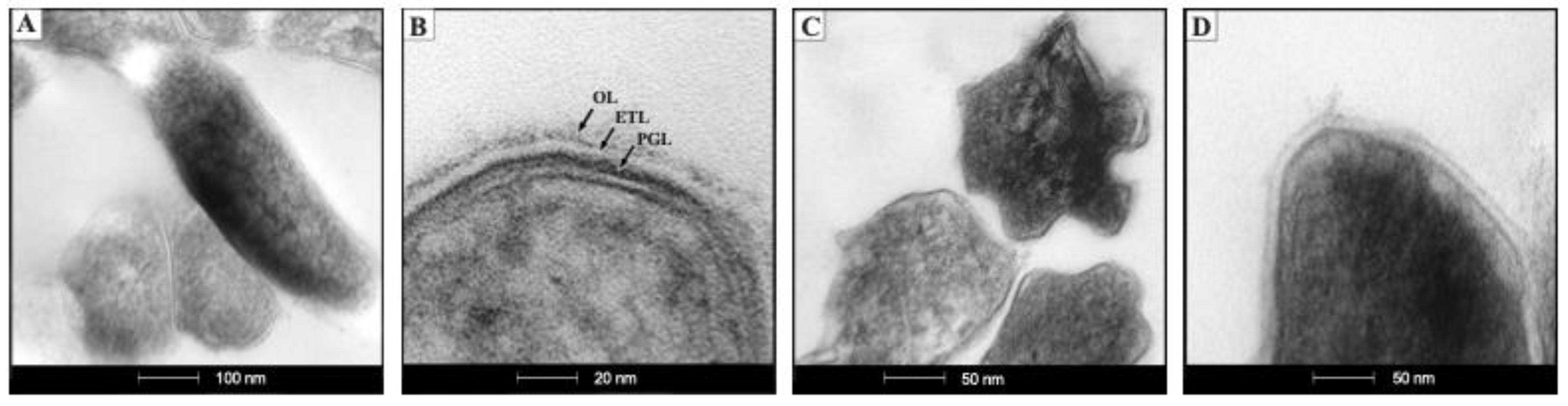 Ijms 23 06015 g002a Ijms 23 06015 g002a