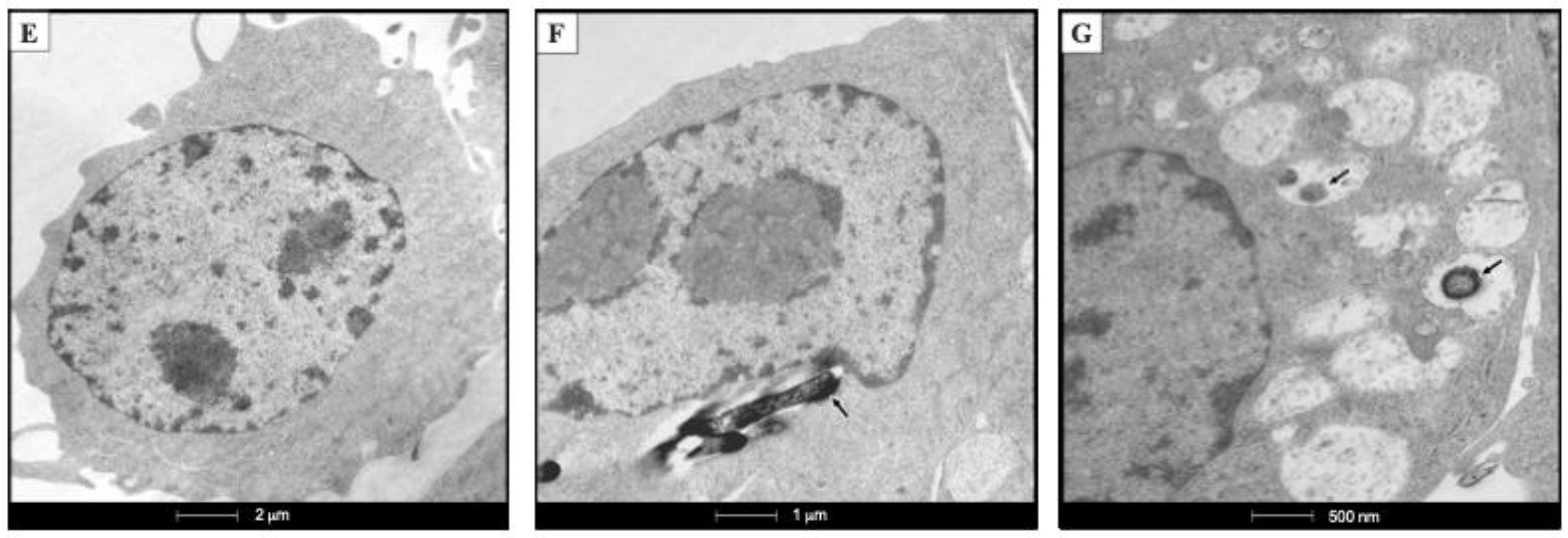 Ijms 23 06015 g002b Ijms 23 06015 g002b