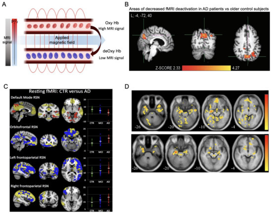 Ijms 23 06079 g004 550