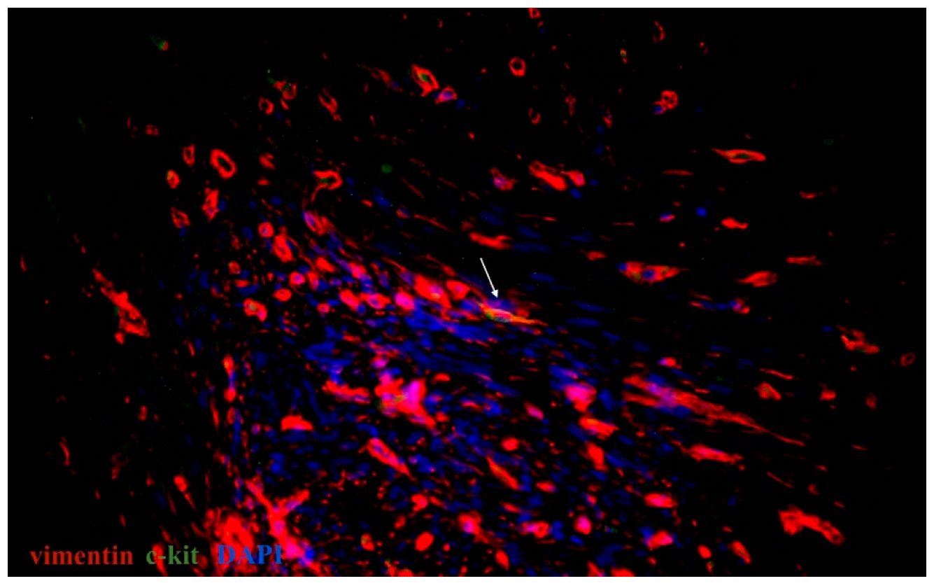 Ijms 23 06155 g004 Ijms 23 06155 g004