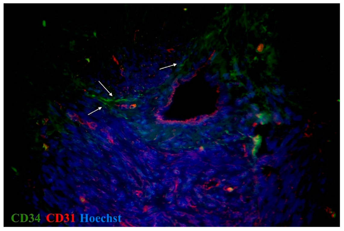 Ijms 23 06155 g005 Ijms 23 06155 g005