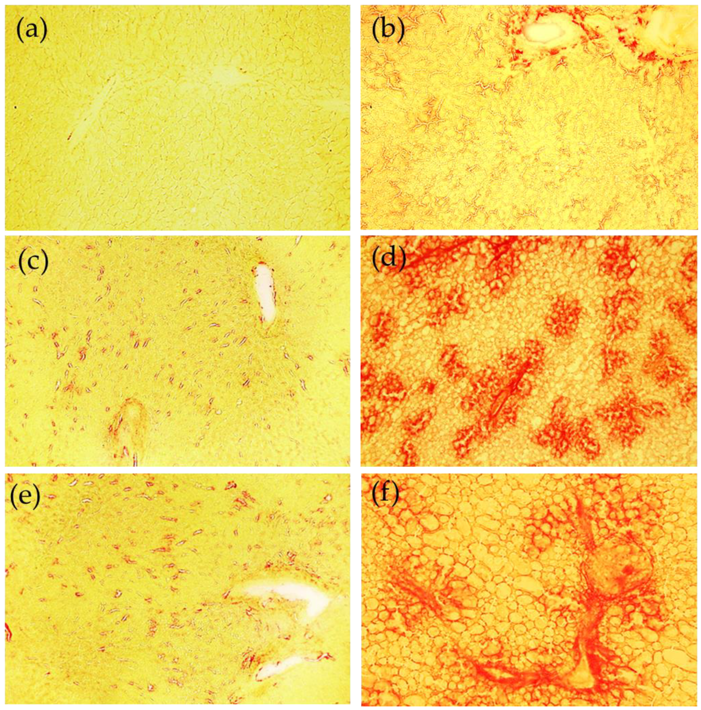 Ijms 23 06817 g004