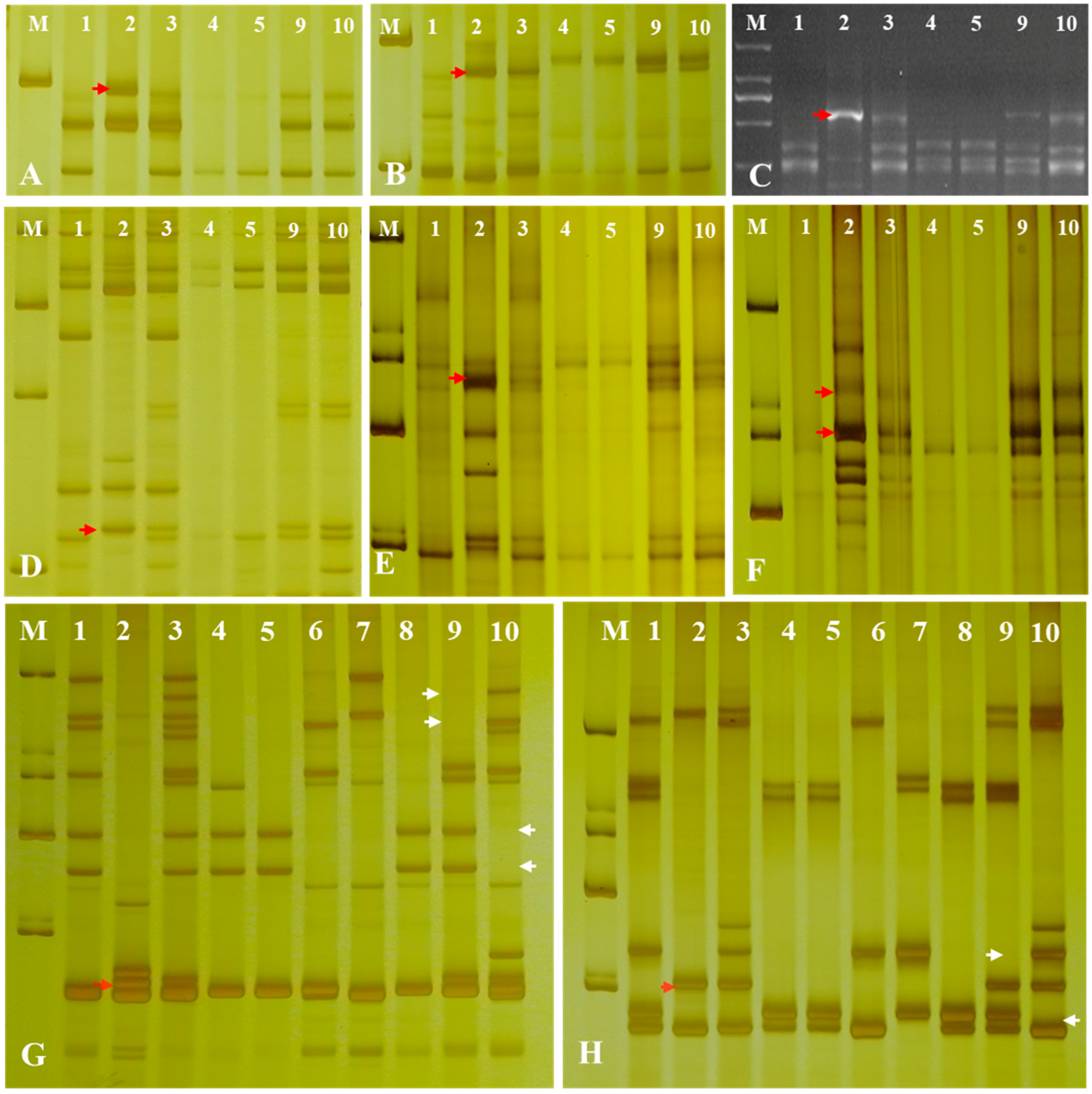 Ijms 23 07056 g004 Ijms 23 07056 g004