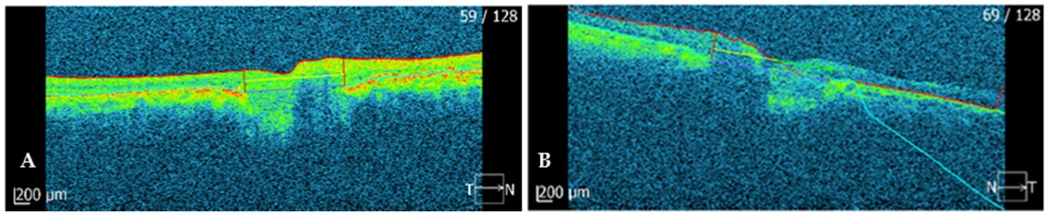 Ijms 23 07582 g002 Ijms 23 07582 g002