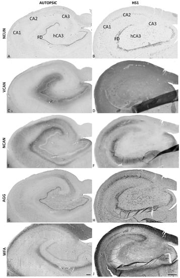 Ijms 23 08197 g003 550