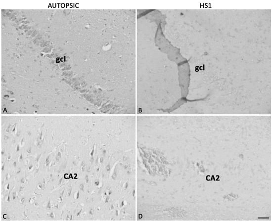 Ijms 23 08197 g005 550