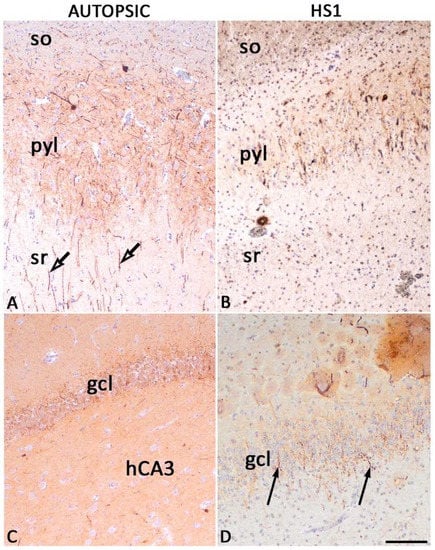 Ijms 23 08197 g007 550