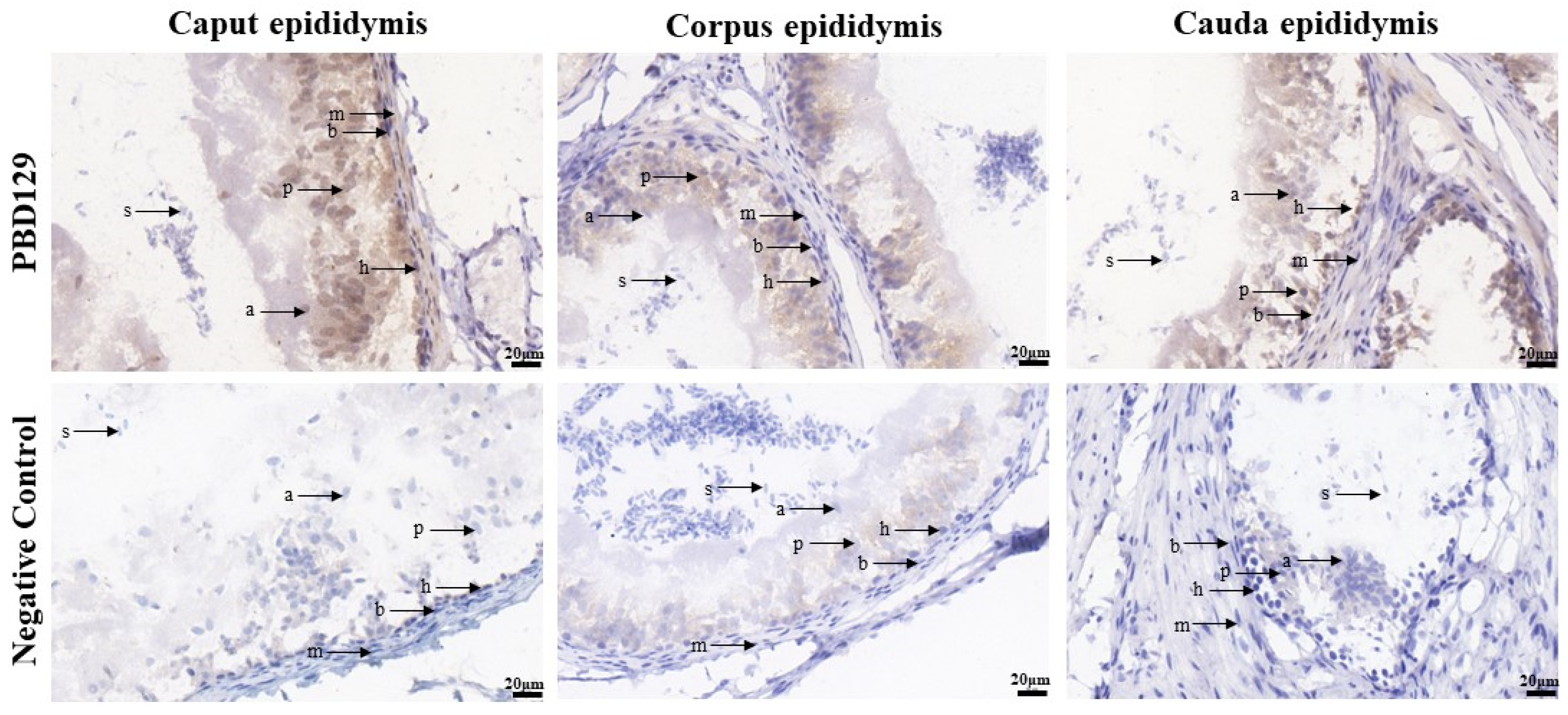Ijms 23 09441 g005 Ijms 23 09441 g005