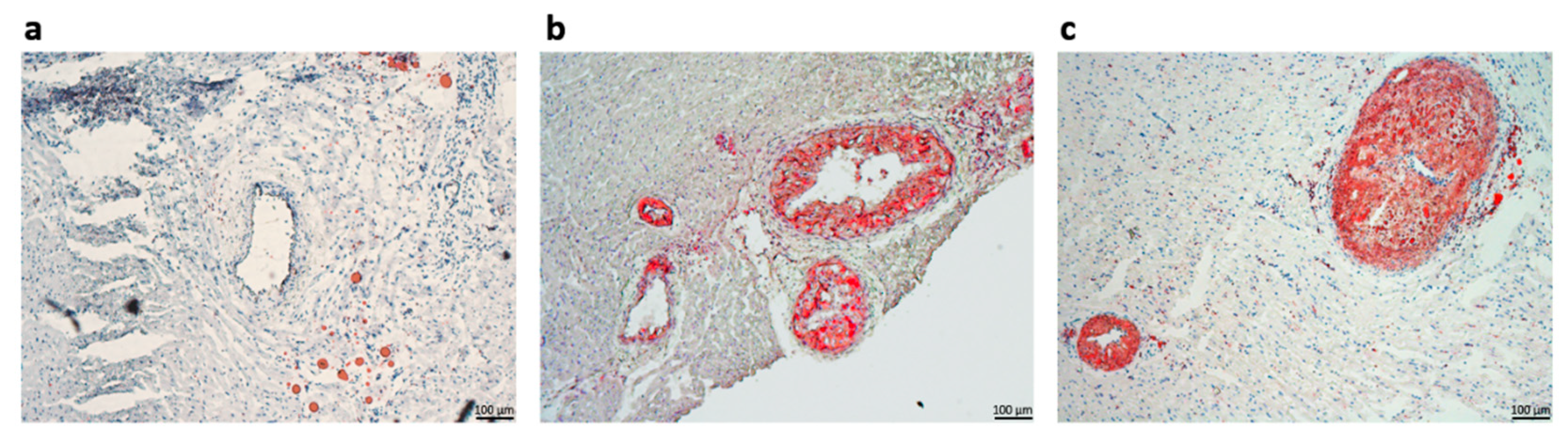 Ijms 23 11174 g004 Ijms 23 11174 g004