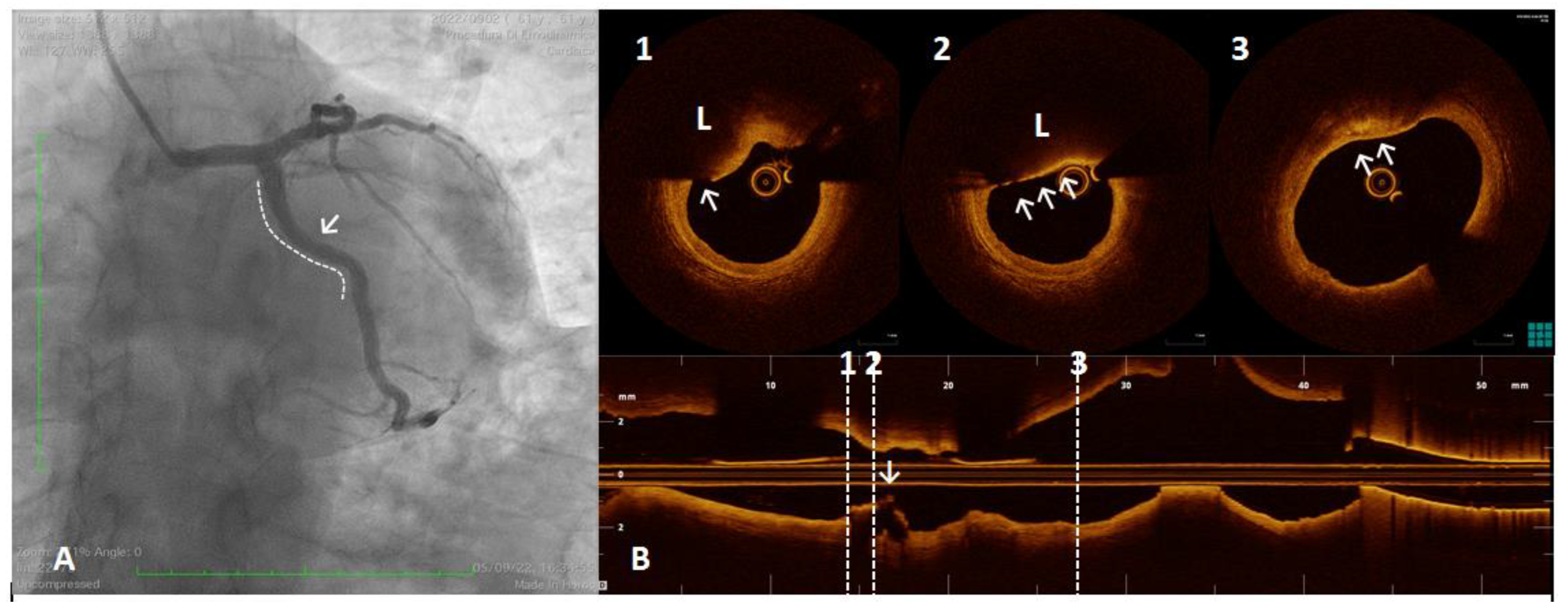 Ijms 23 12906 g005 Ijms 23 12906 g005