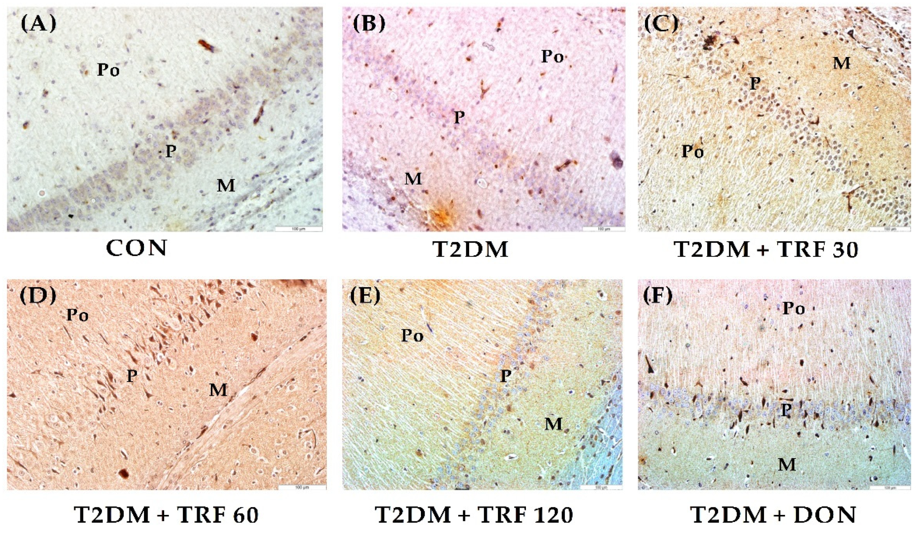 Ijms 23 13531 g004 Ijms 23 13531 g004