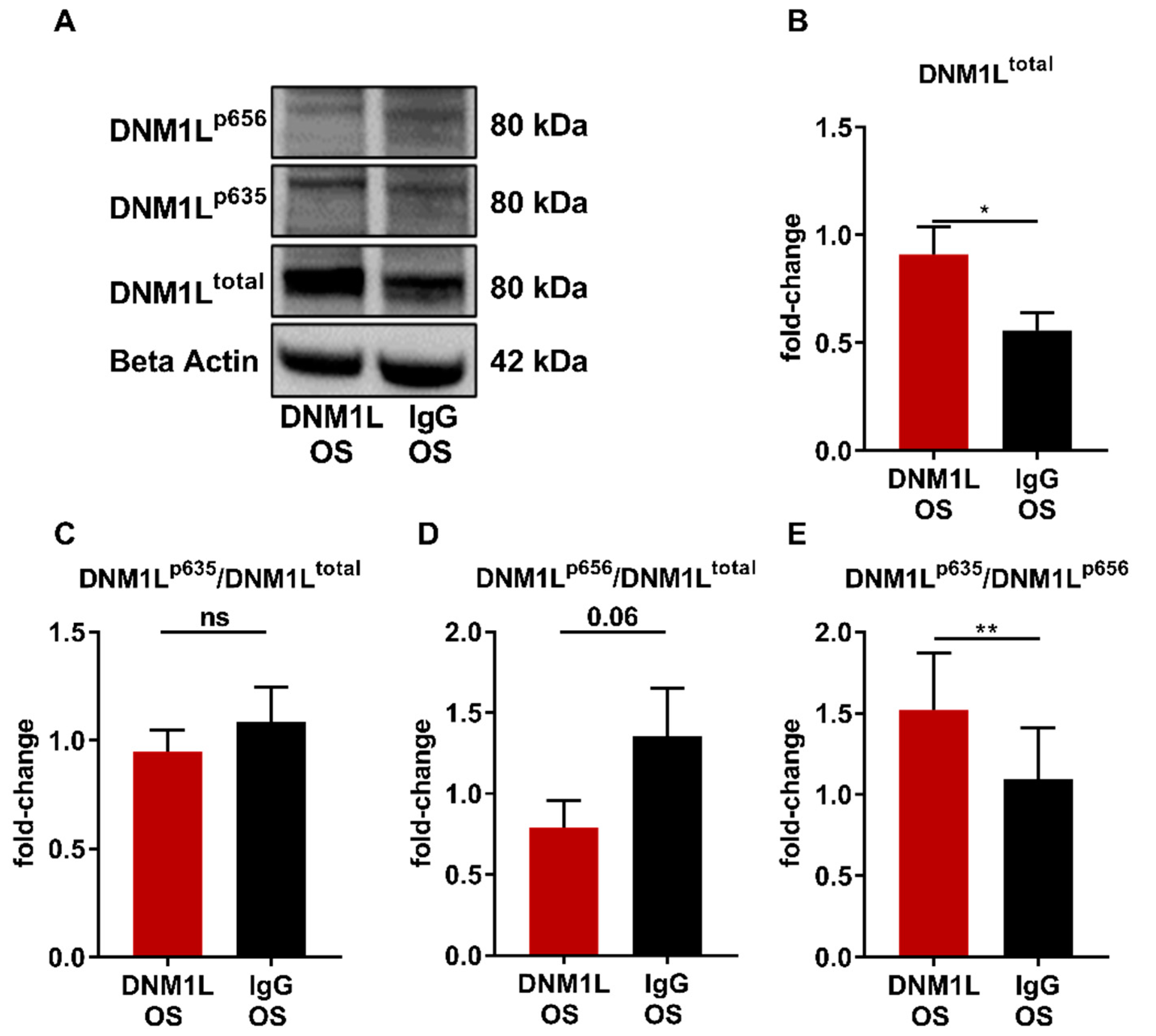 Ijms 23 13618 g005 Ijms 23 13618 g005