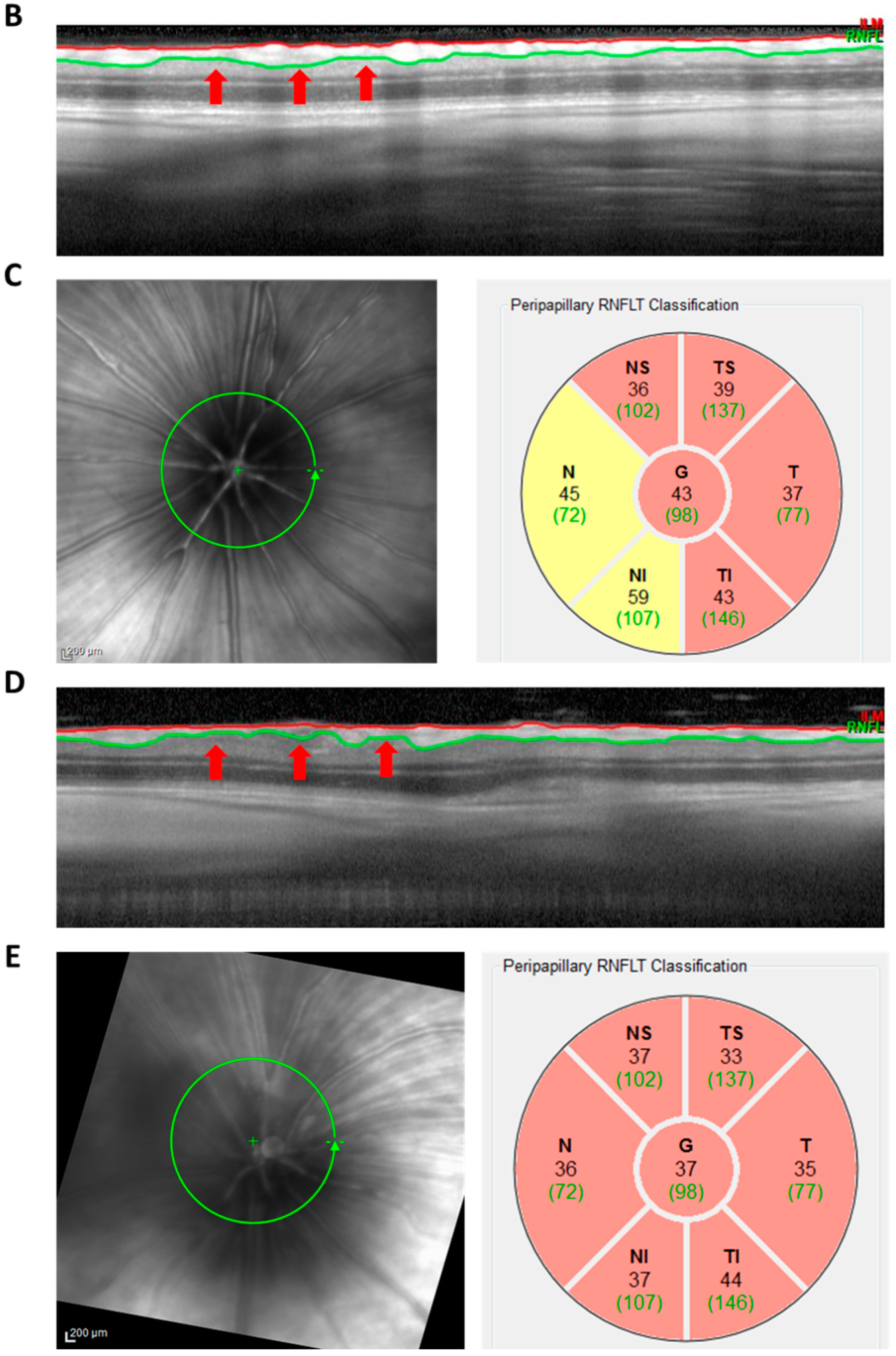 Ijms 23 13618 g0a2b Ijms 23 13618 g0a2b