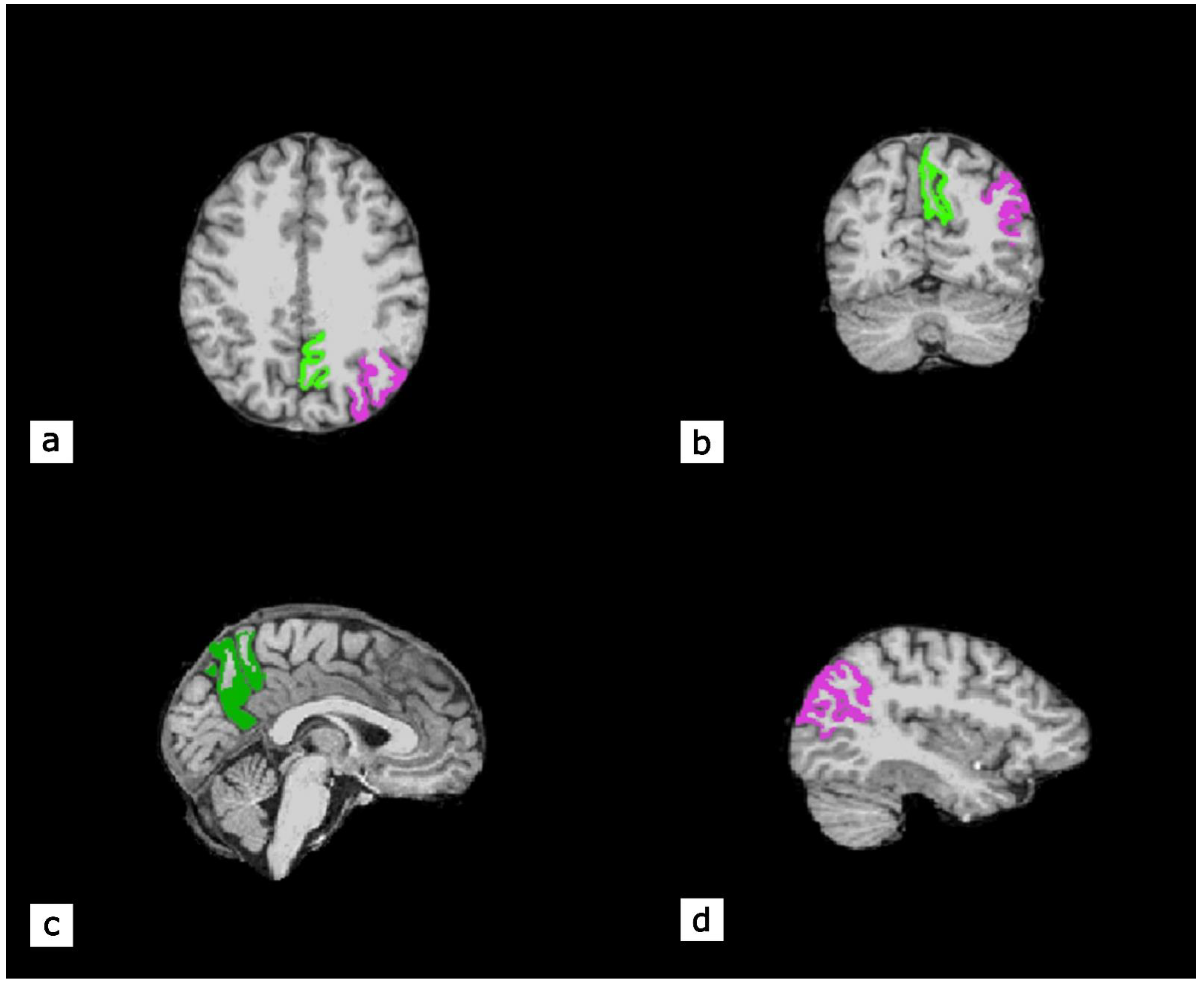 Ijms 23 16031 g005 Ijms 23 16031 g005