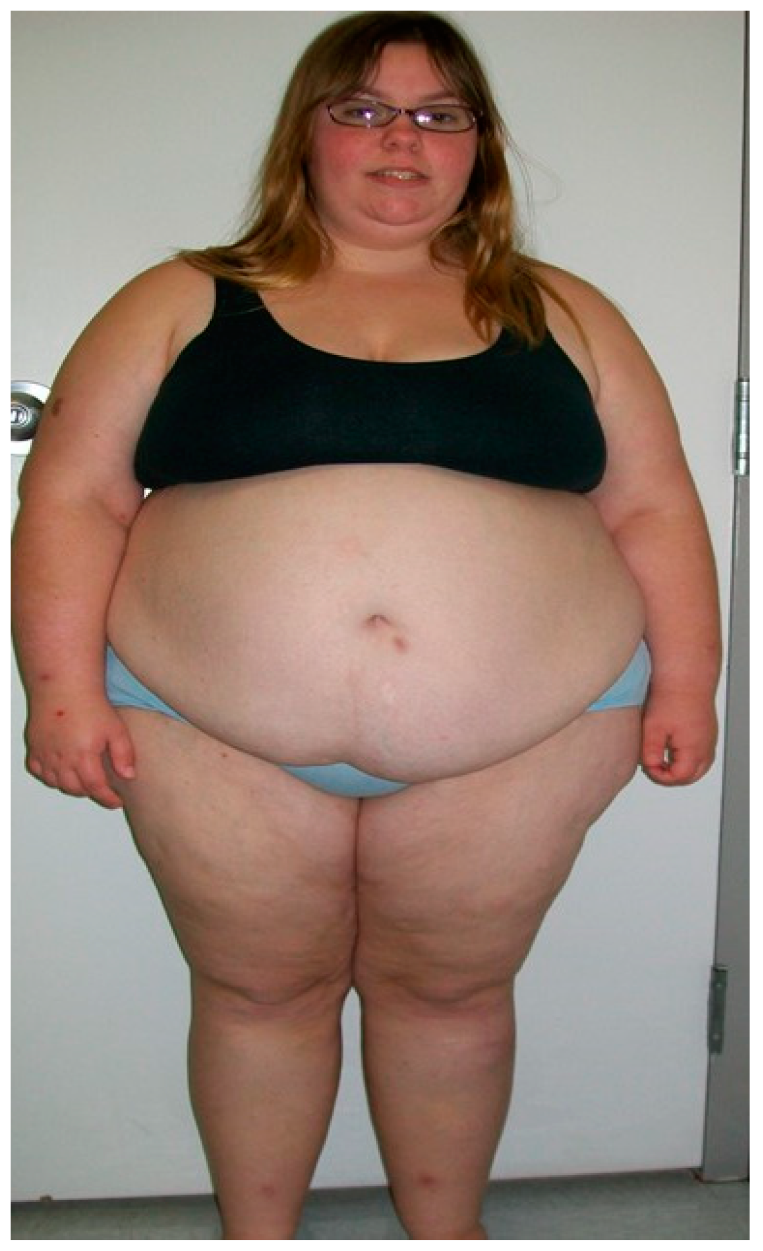 Ijms 24 02150 g001 Ijms 24 02150 g001