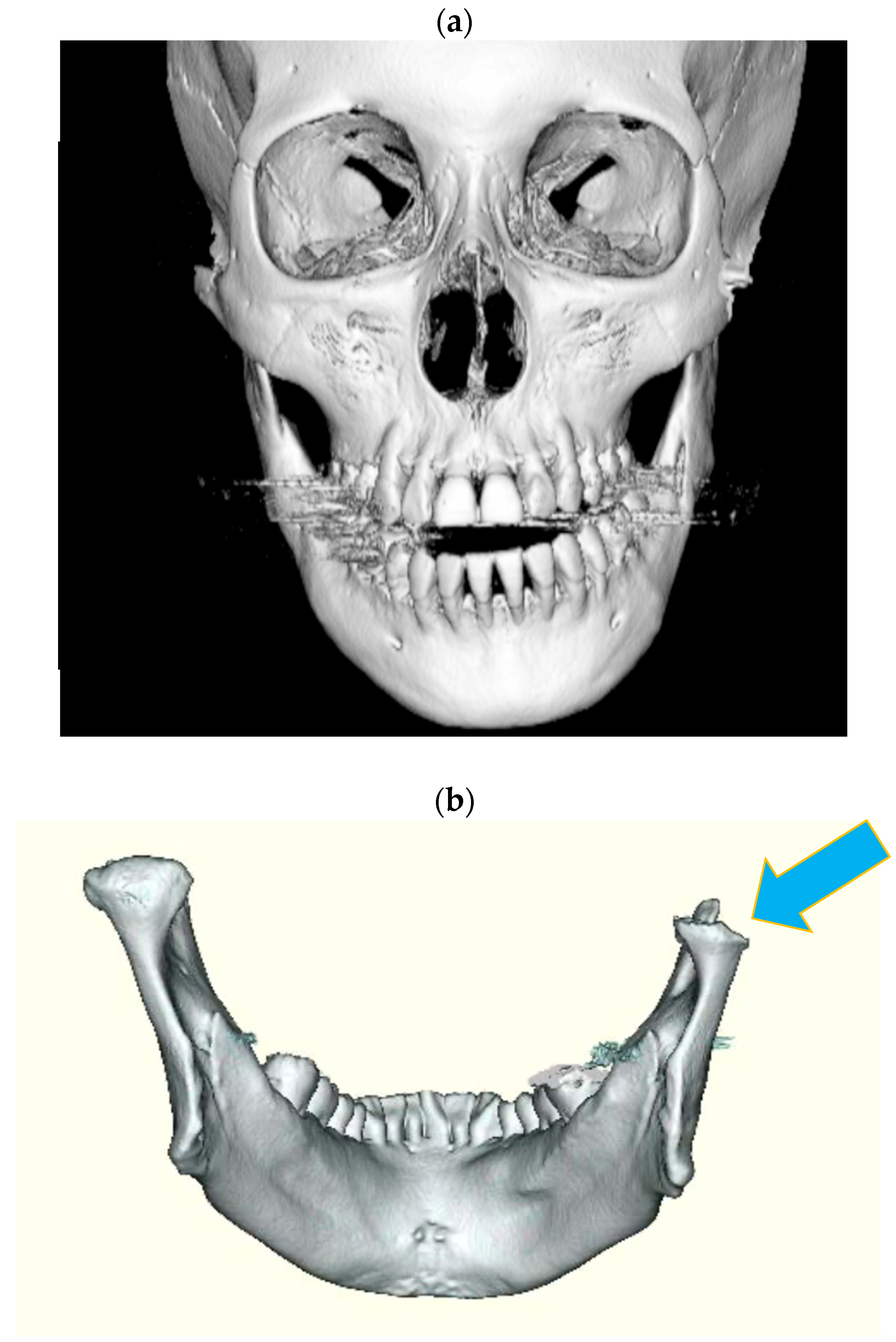 Ijms 24 02775 g008 Ijms 24 02775 g008
