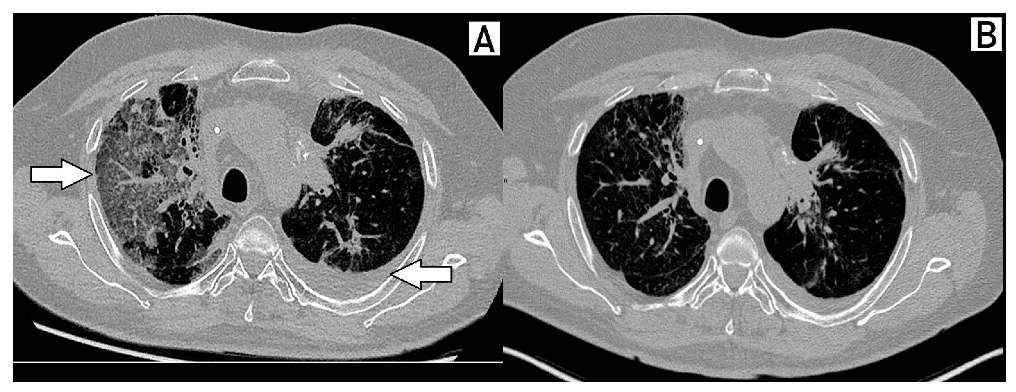 Ijms 24 04209 g003 Ijms 24 04209 g003