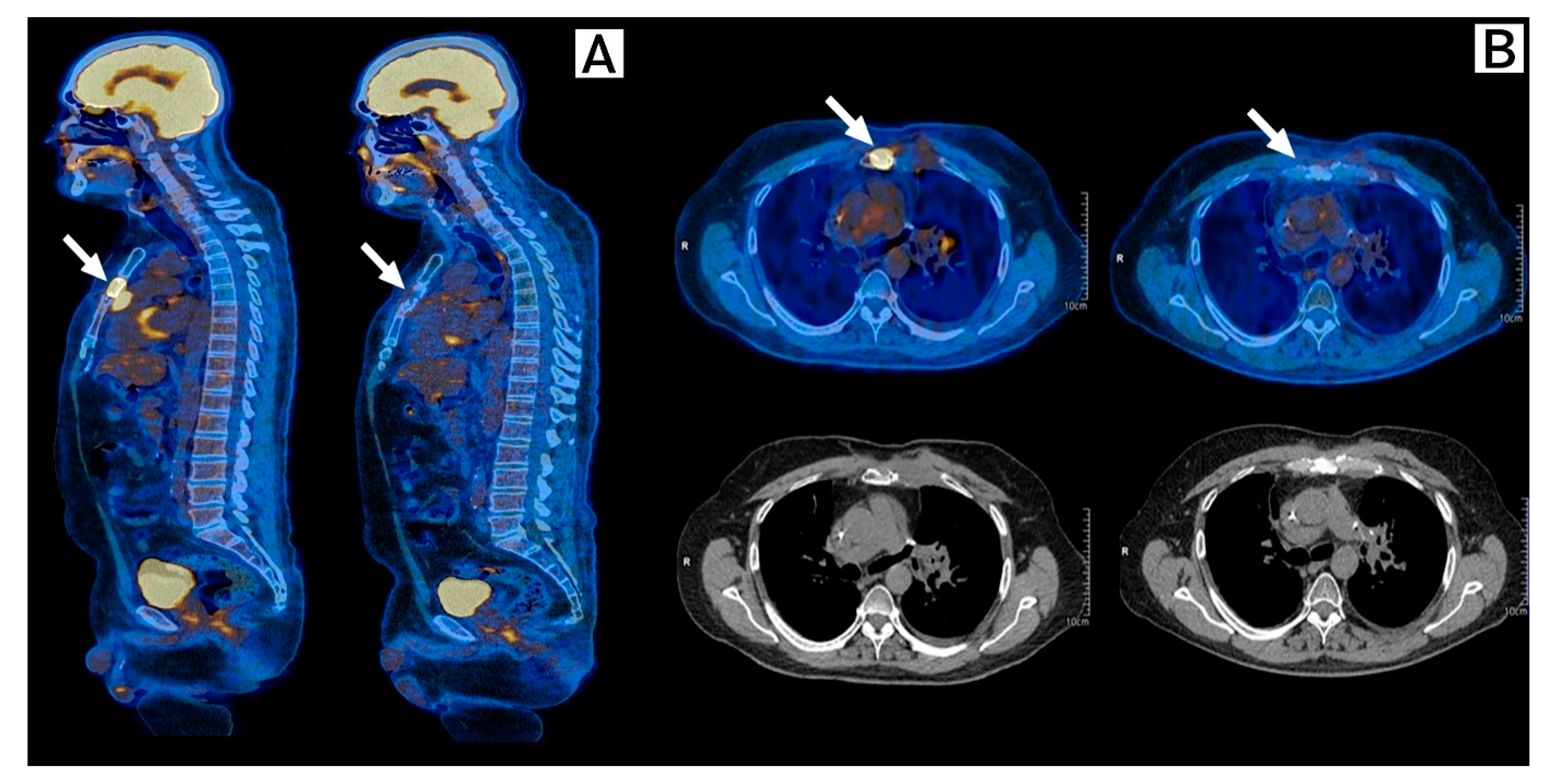 Ijms 24 04209 g004 Ijms 24 04209 g004