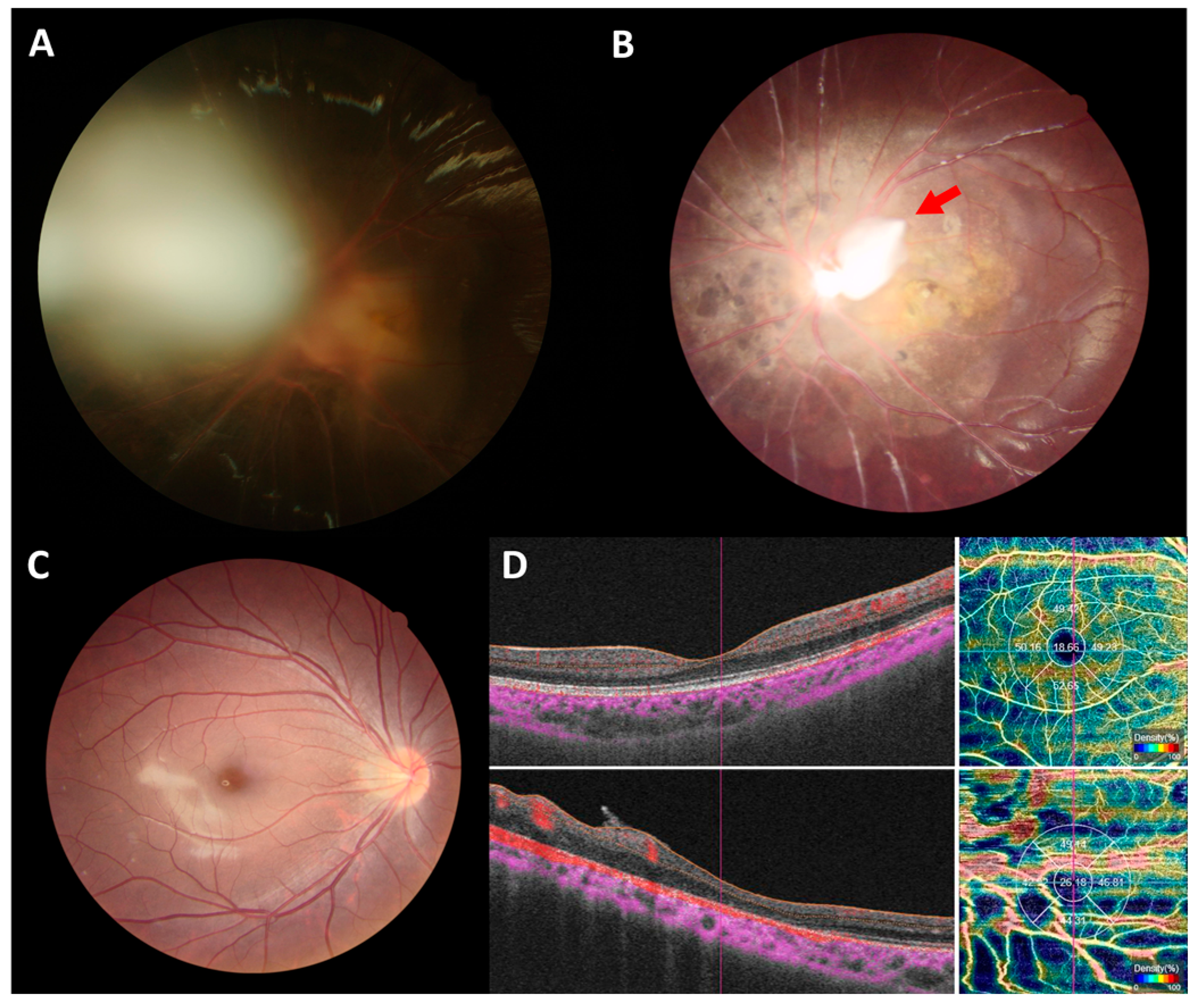 Ijms 24 05836 g003 Ijms 24 05836 g003