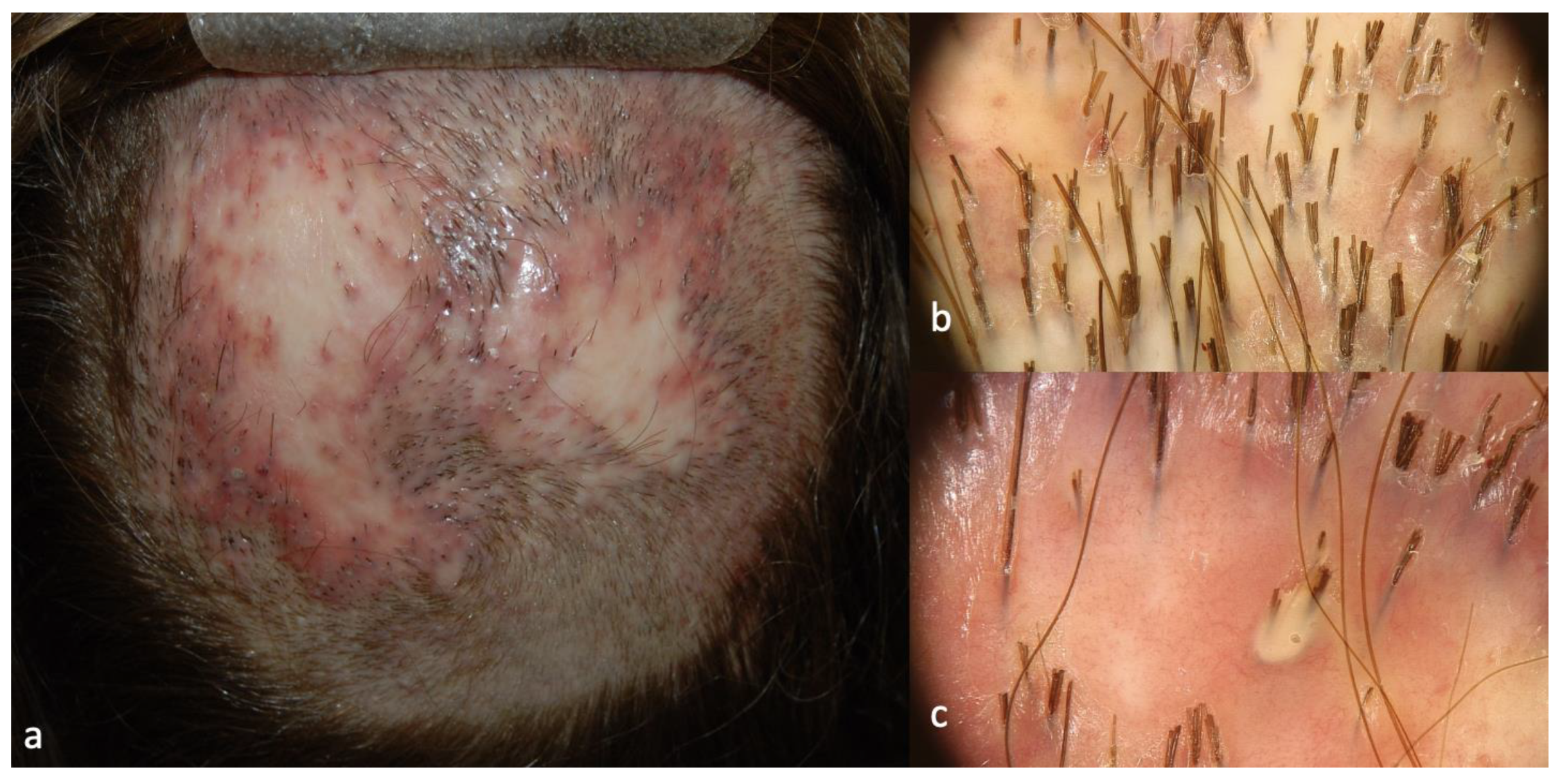 Ijms 24 06678 g004 Ijms 24 06678 g004