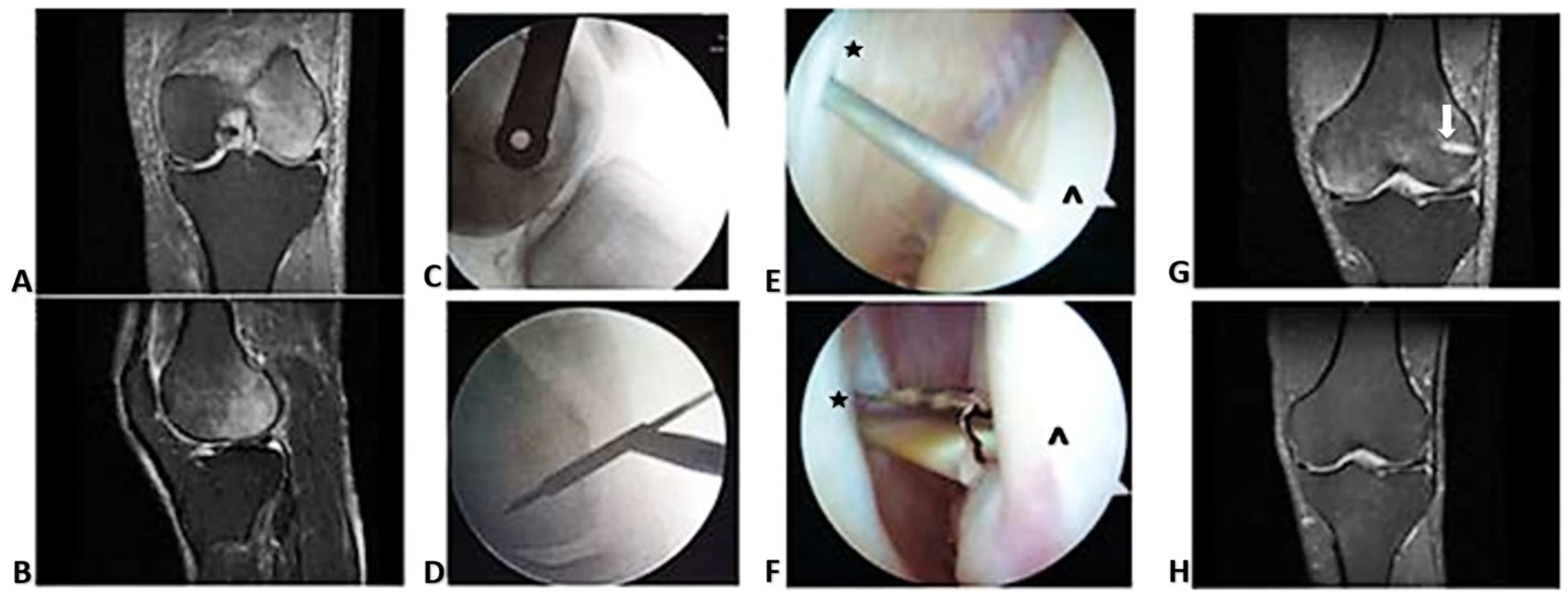 Ijms 24 06761 g002 Ijms 24 06761 g002