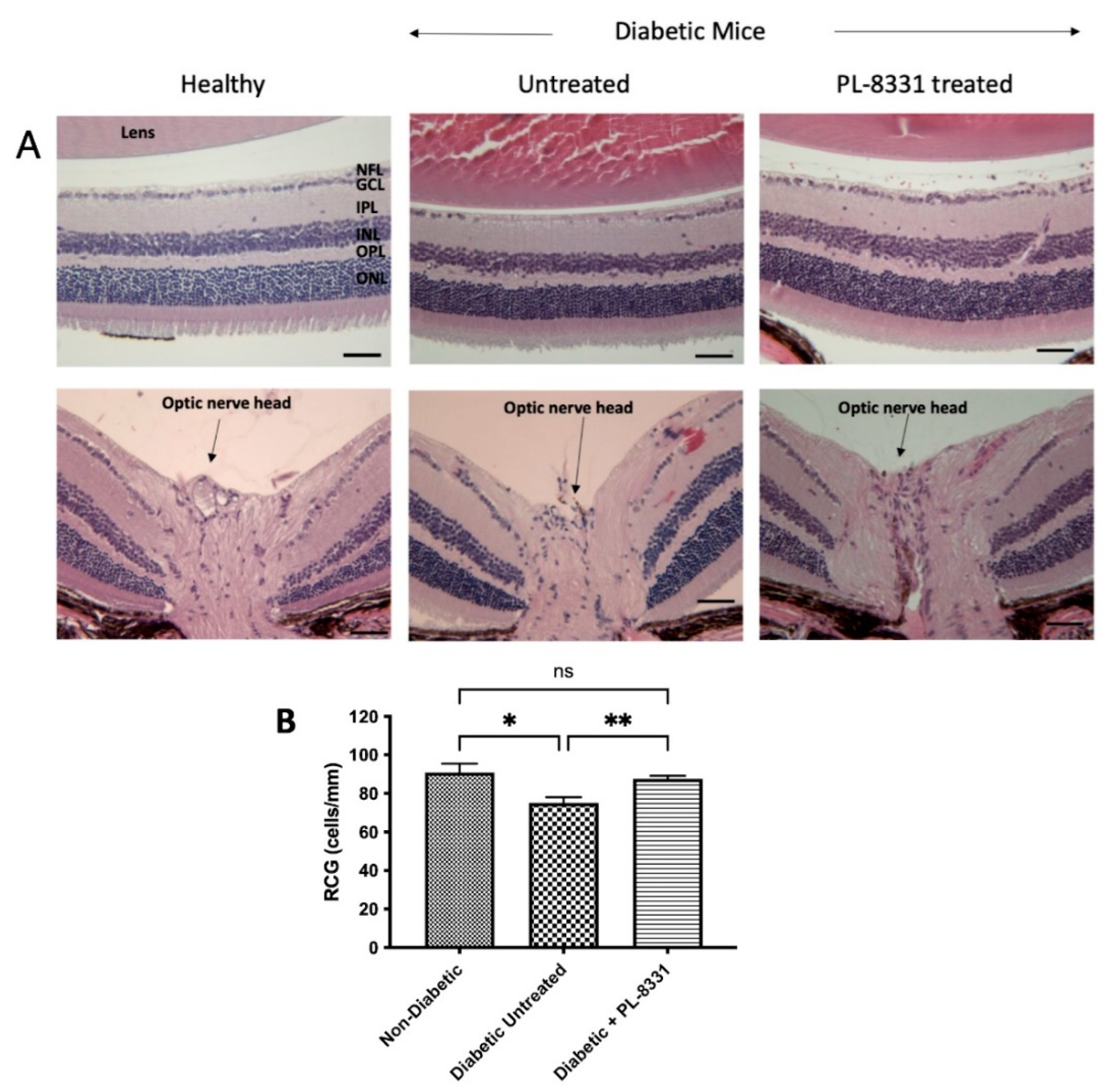 Ijms 24 06928 g003 Ijms 24 06928 g003