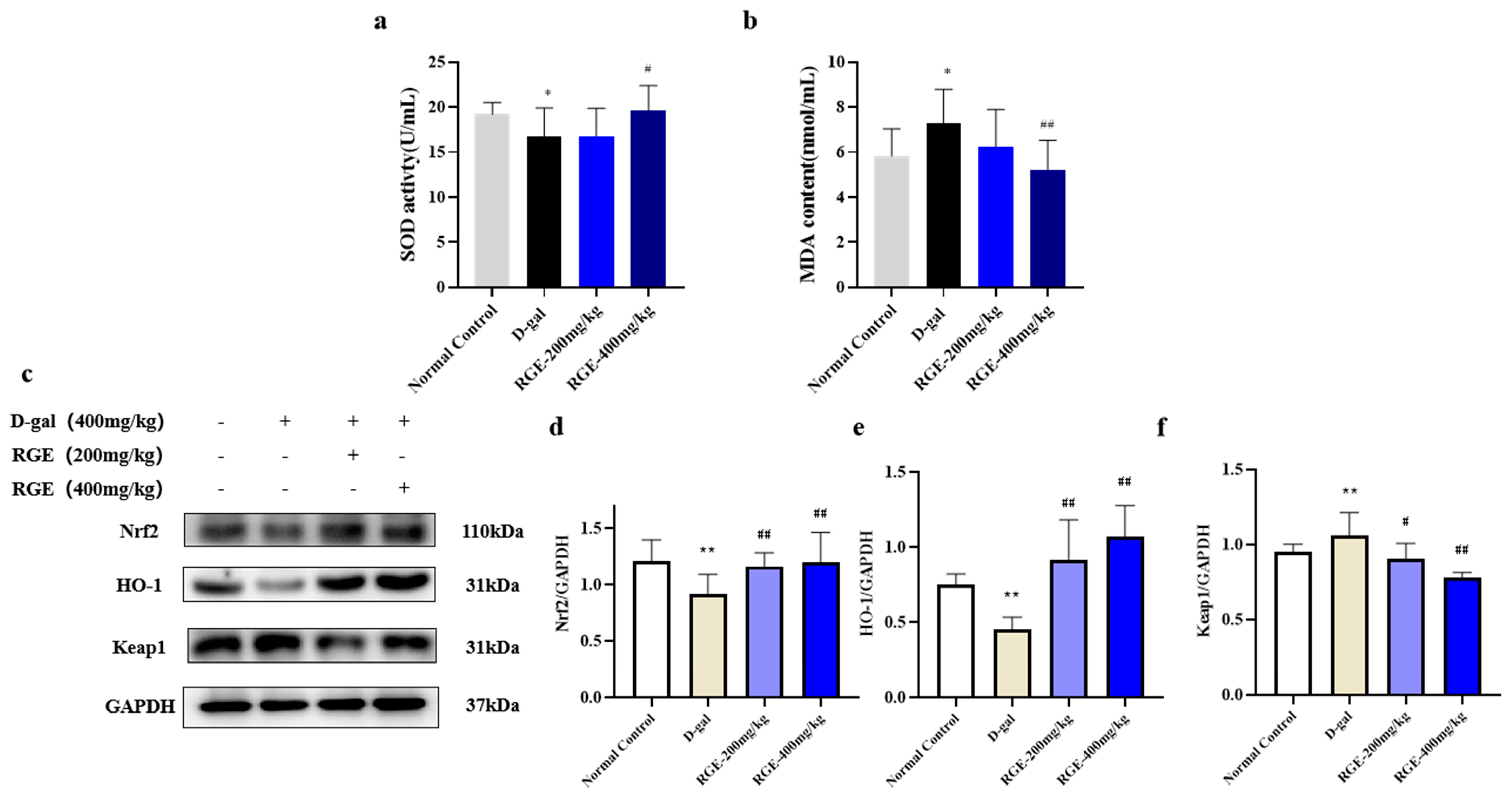 Ijms 24 08210 g003 Ijms 24 08210 g003
